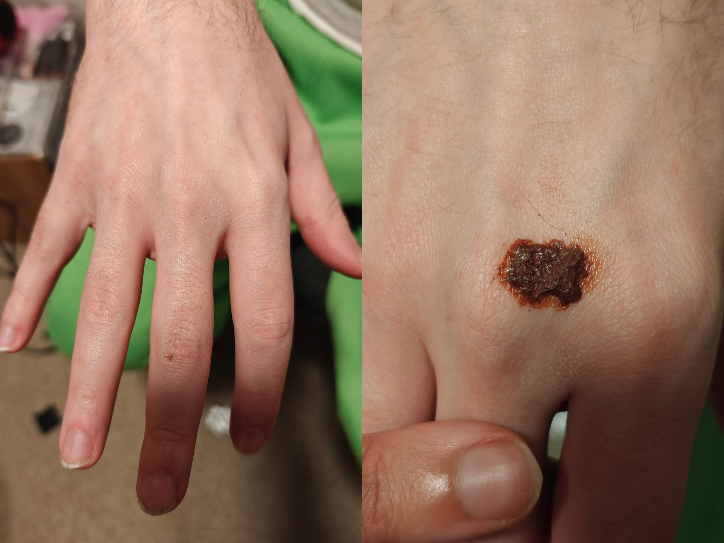 Andy Scab Before After.png