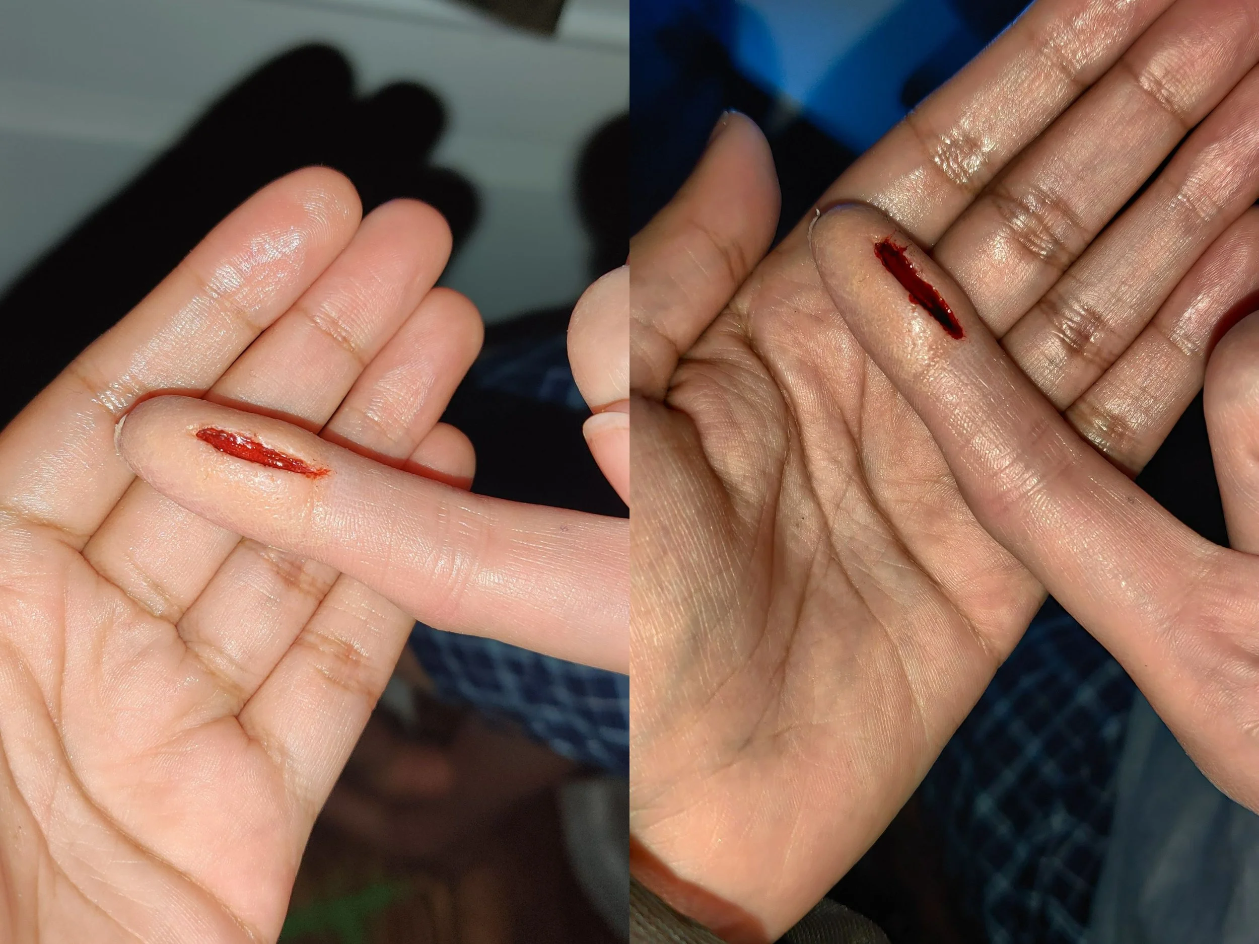 fingercut.jpg