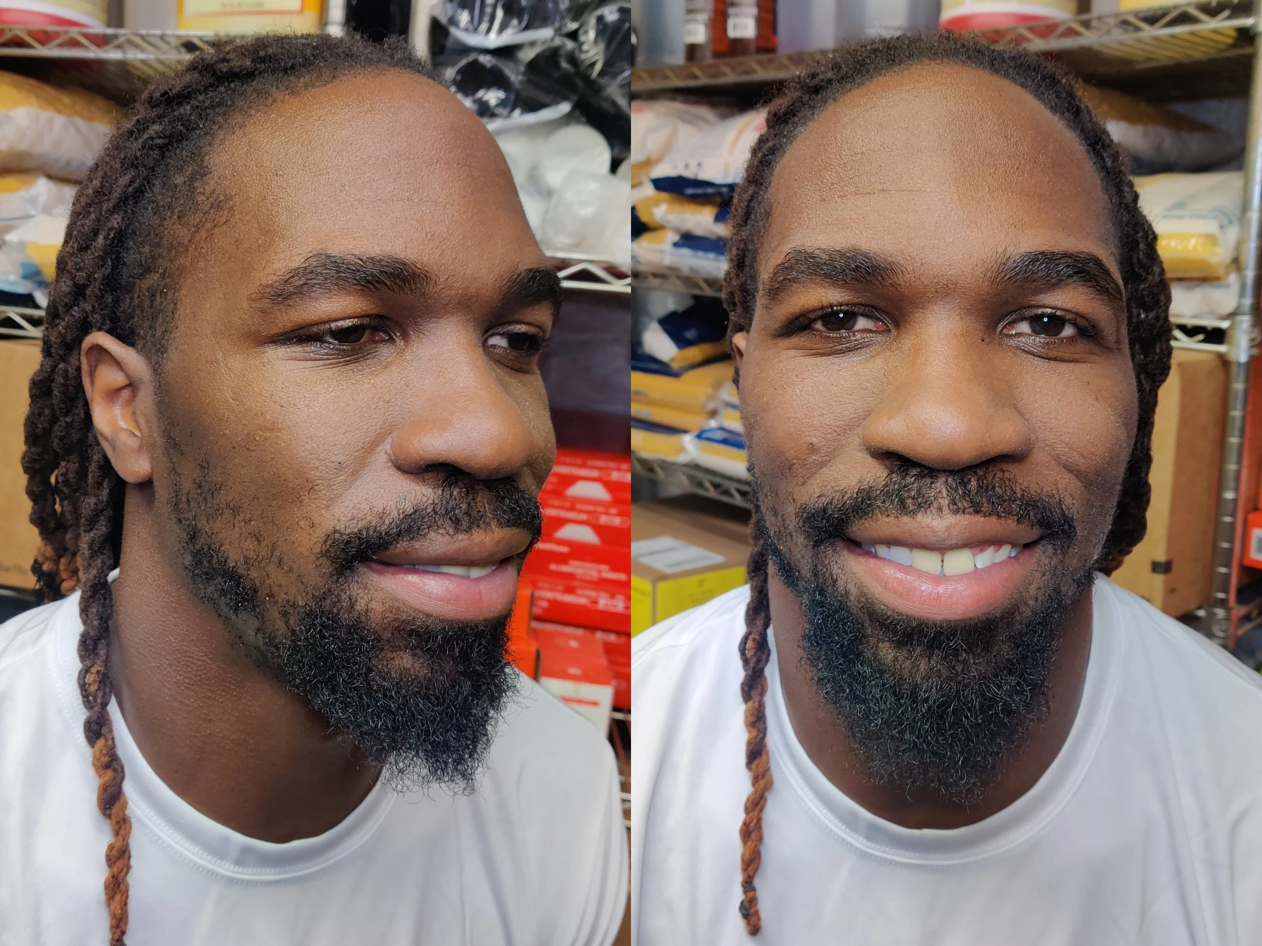 New York Jets linebacker CJ Mosley before atrophic scar application