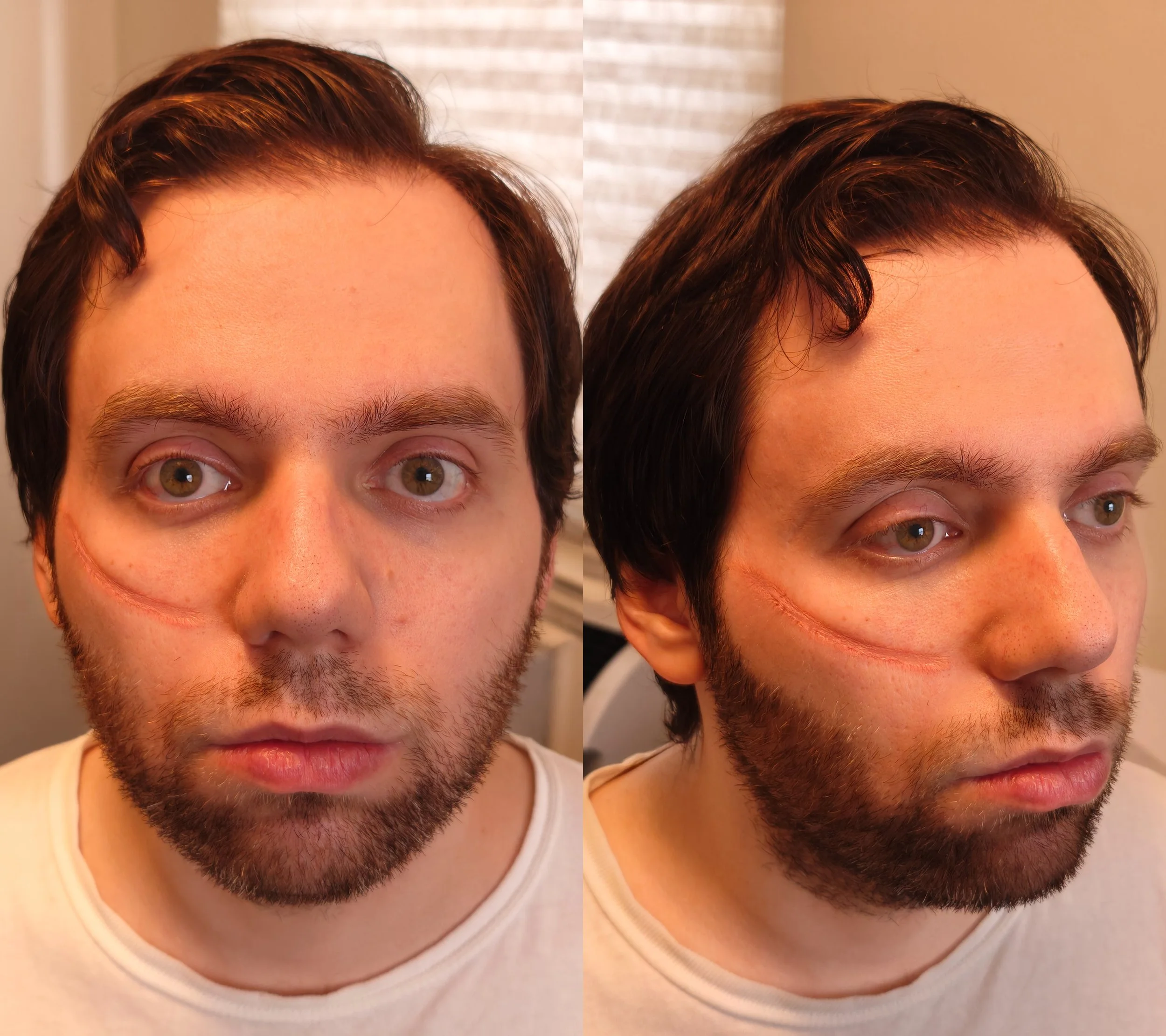 Process 2