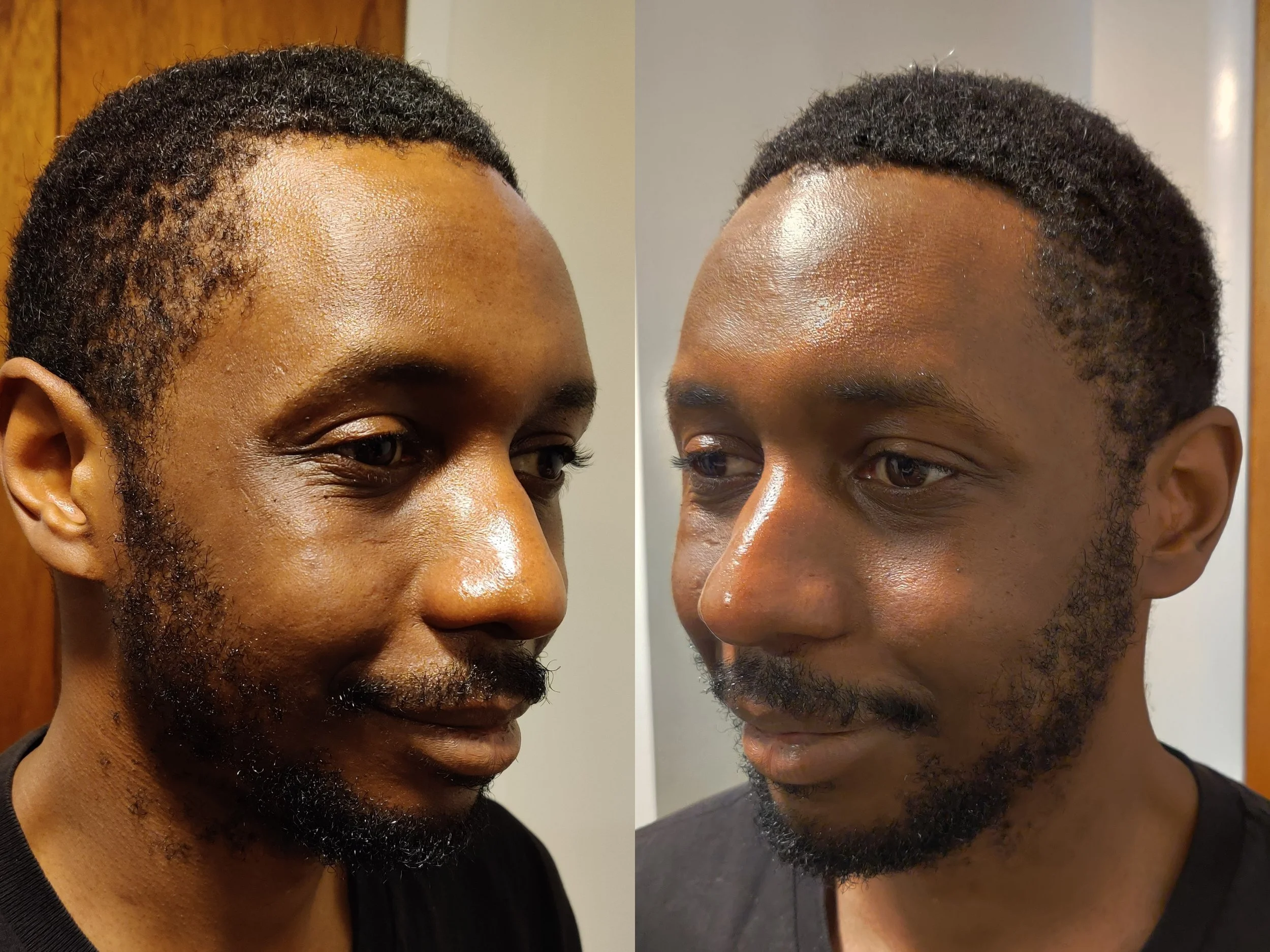 Before stage/highlight & shadow aging process (sides).