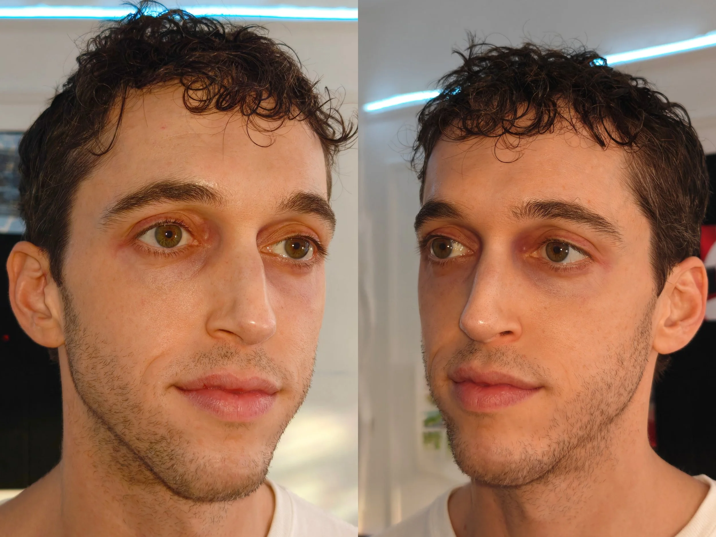 Slightly tired/haggard and greasy-haired look (sides)