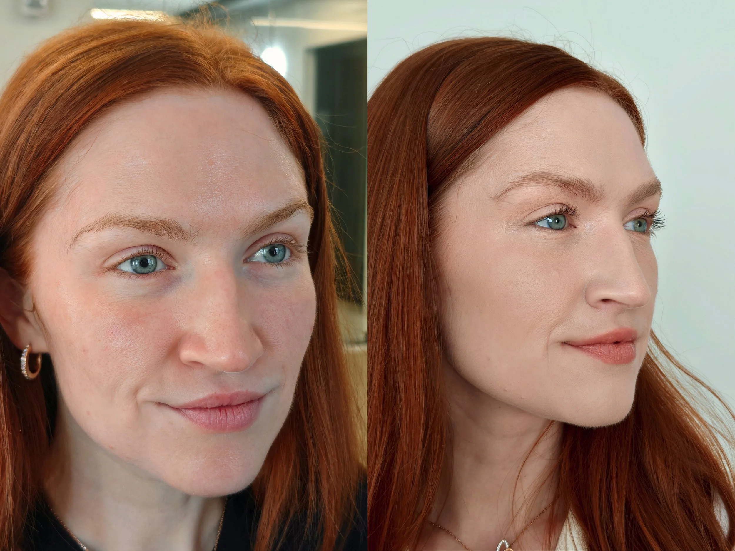 beauty before right.jpg