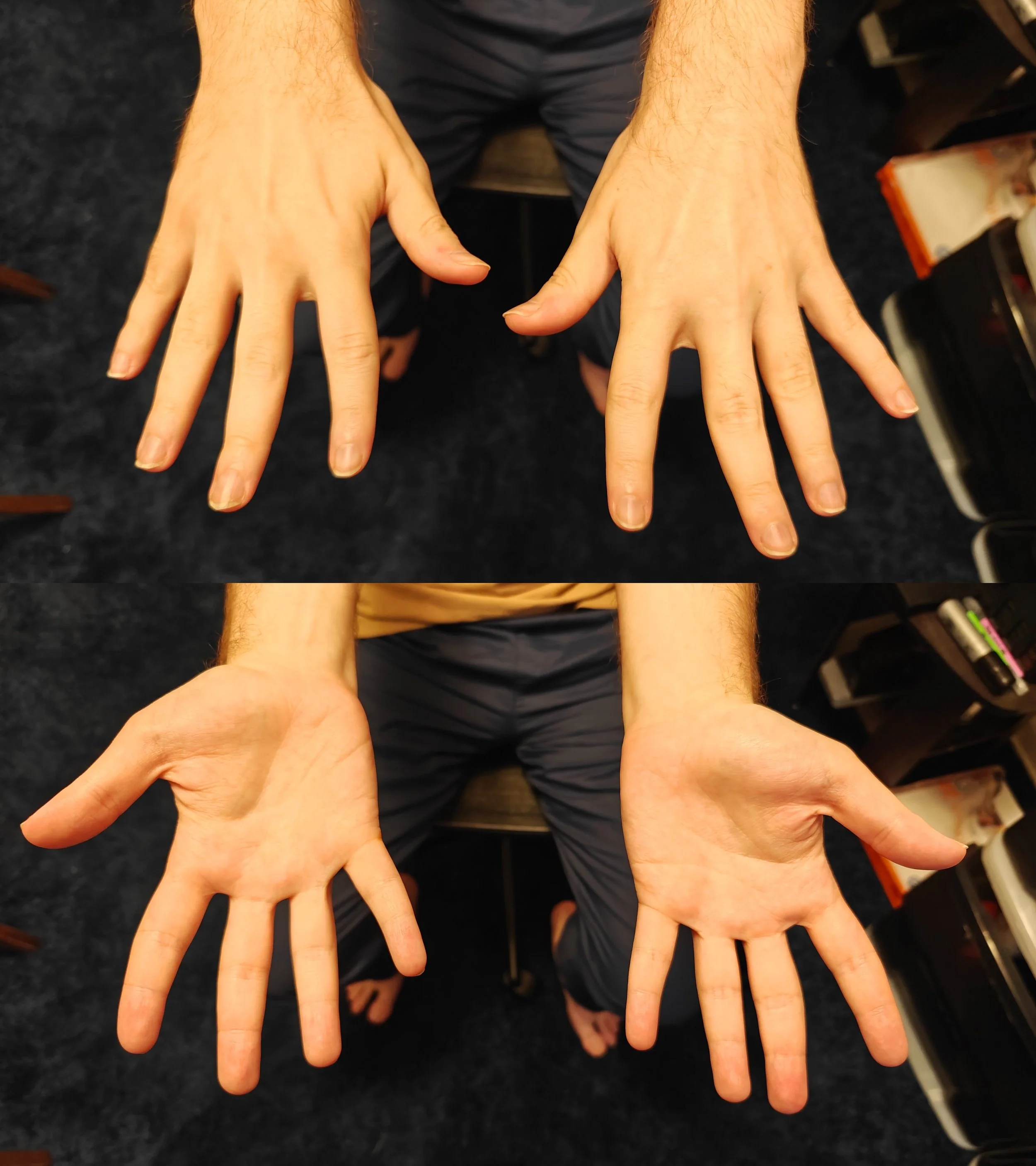 Dirty/weathered hands (before)