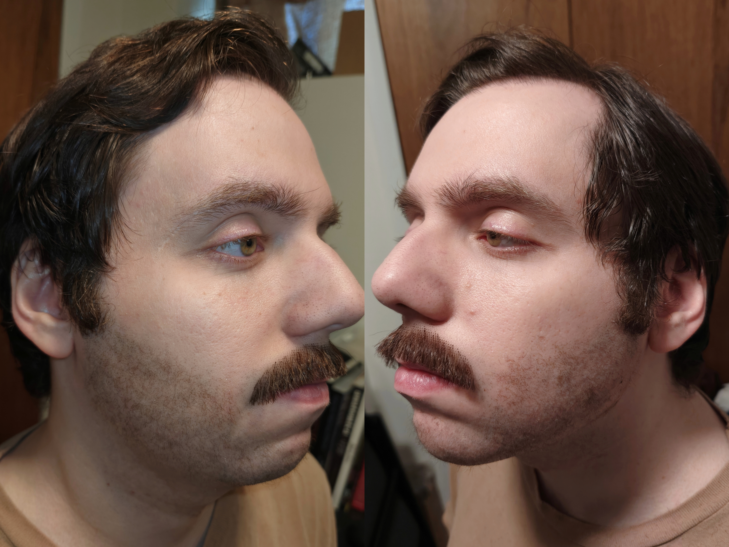 andrew stubble sides.png