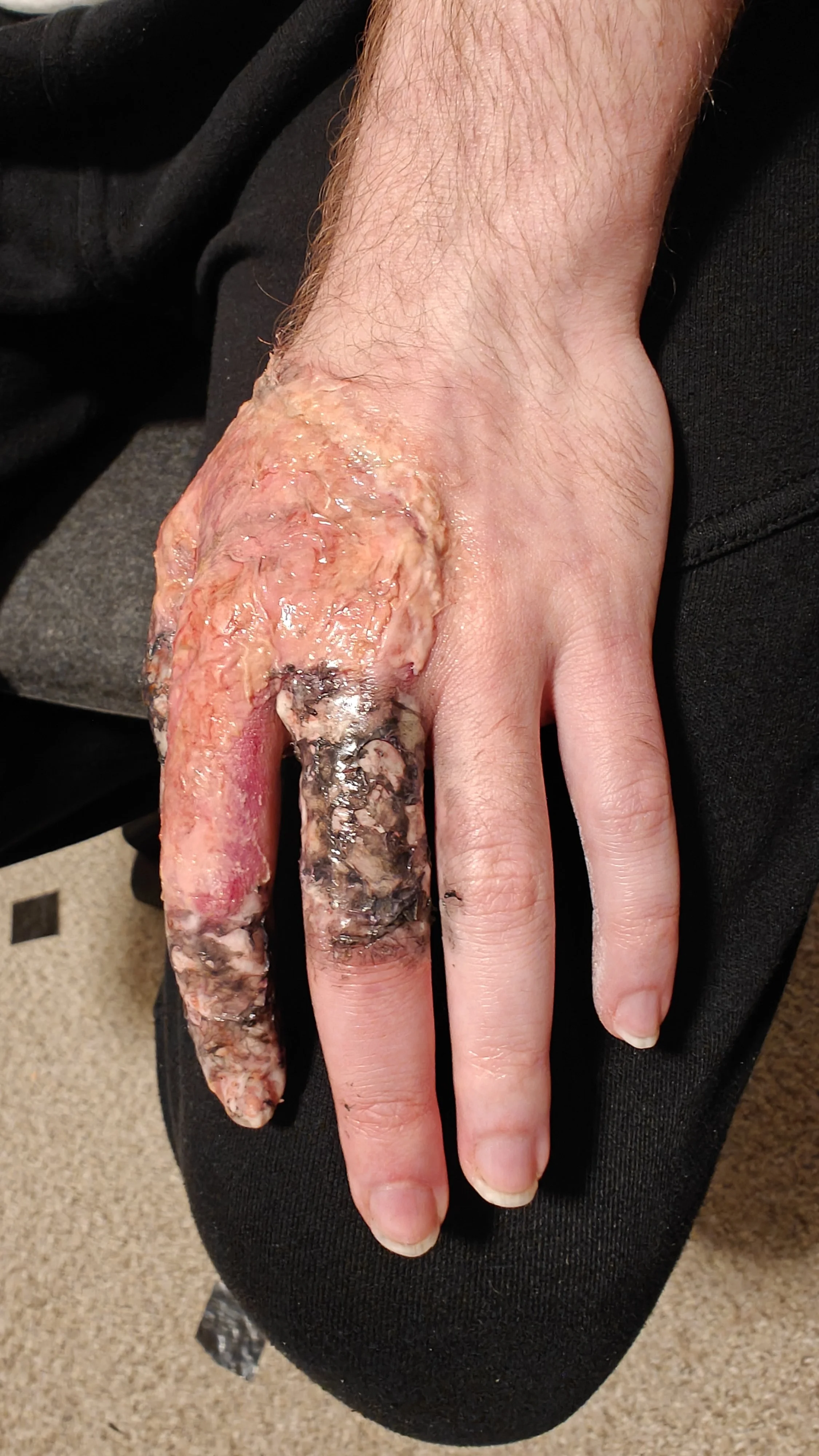 After (alternate angle)