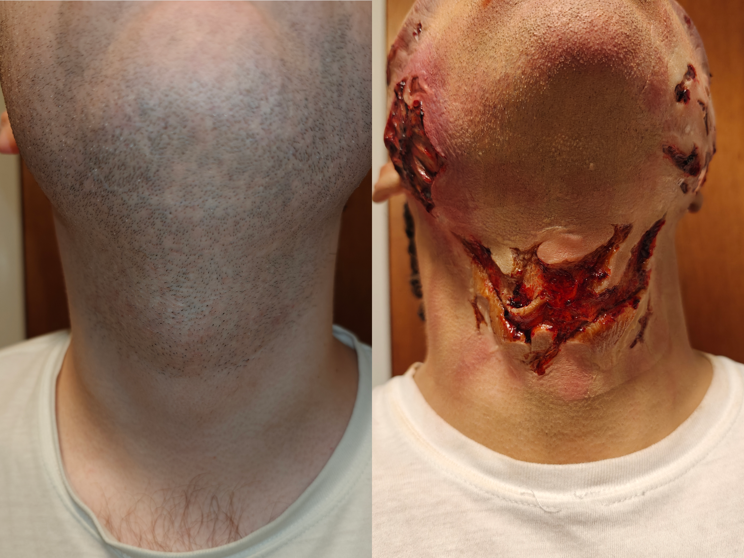 before and after zombie neck.png
