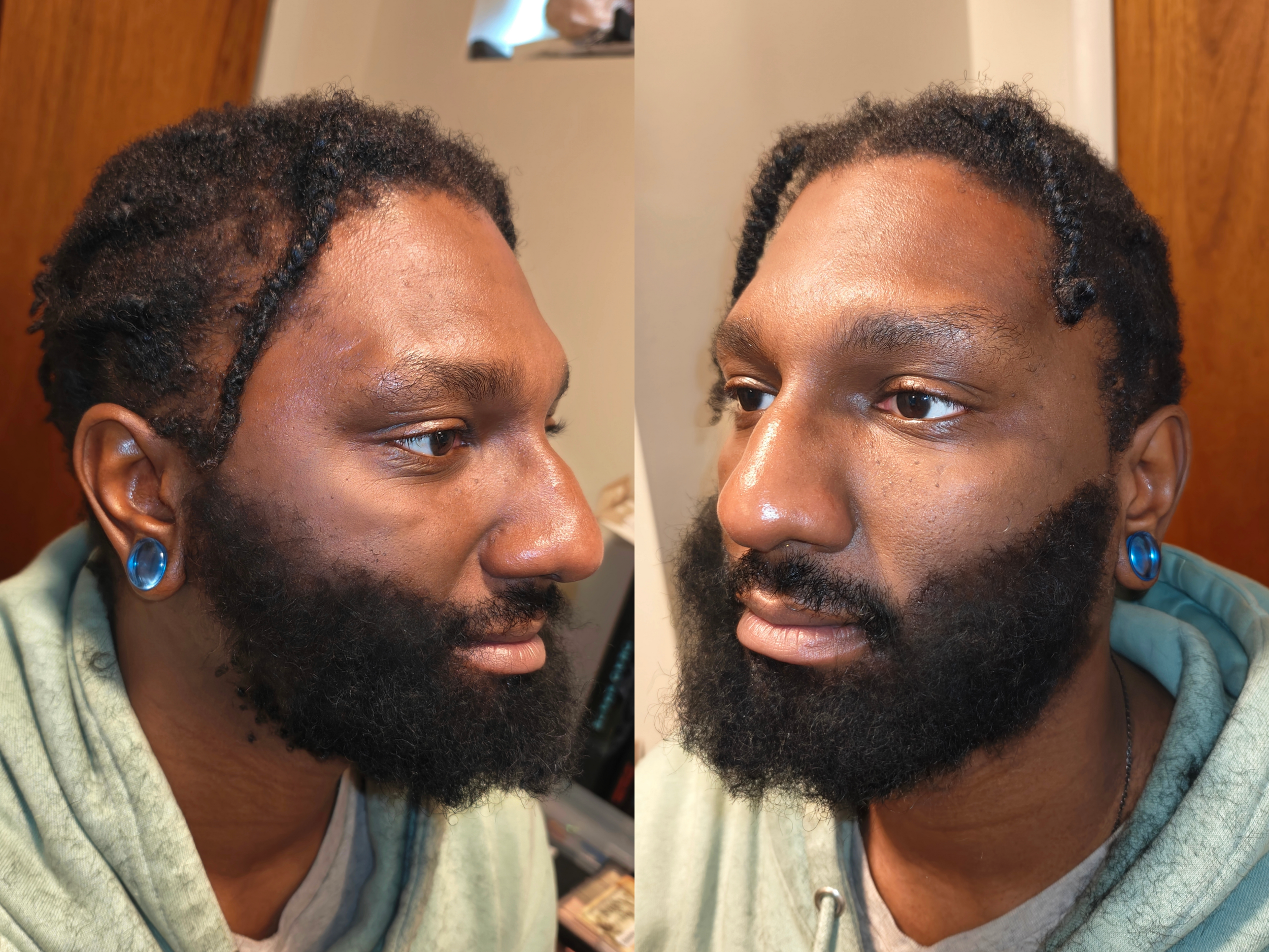 Jay Beard After Sides.png