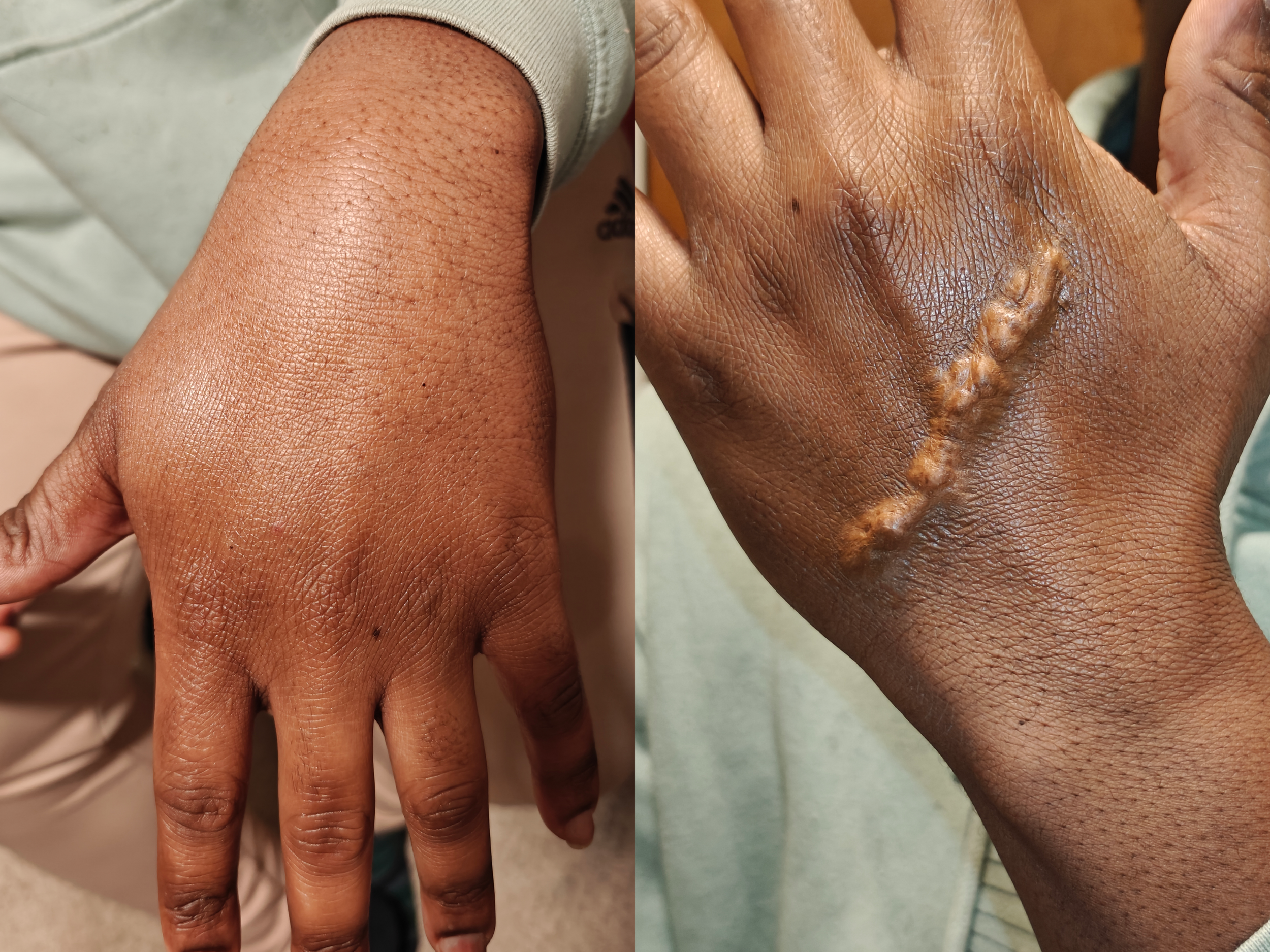 Jay Scar Before After.png
