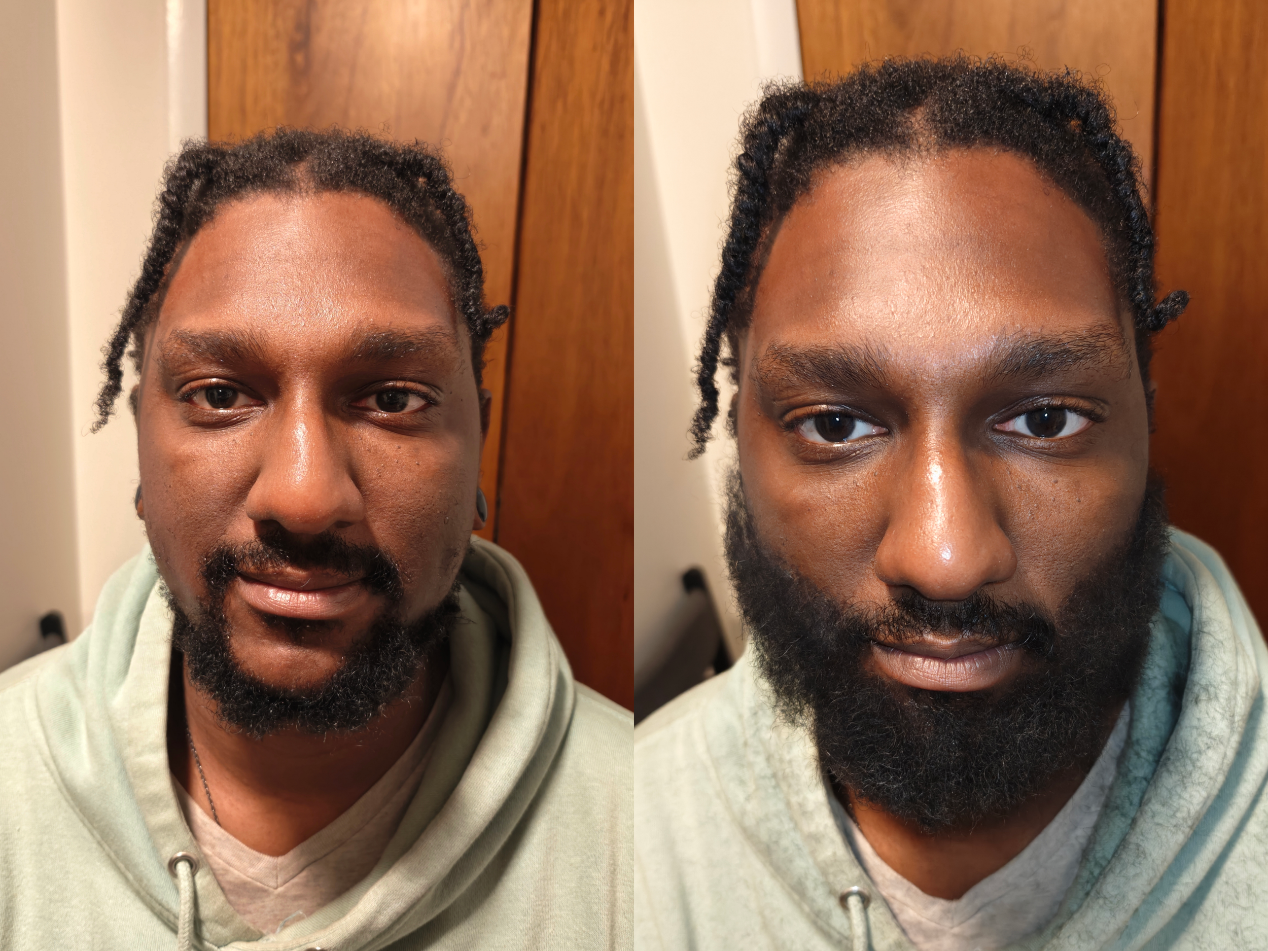 Jay Beard Before After.png