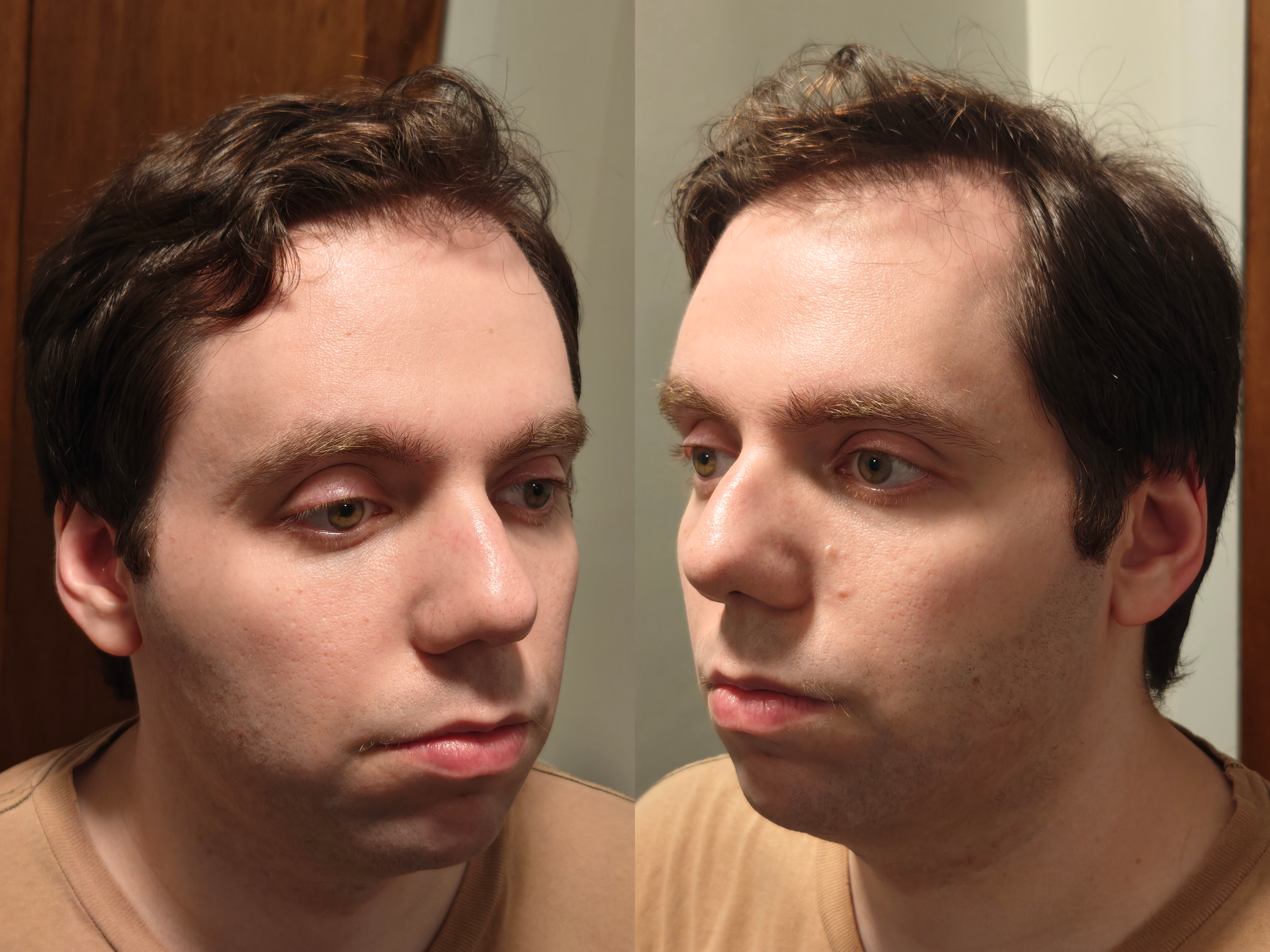 Before stage/highlight & shadow aging process (sides)