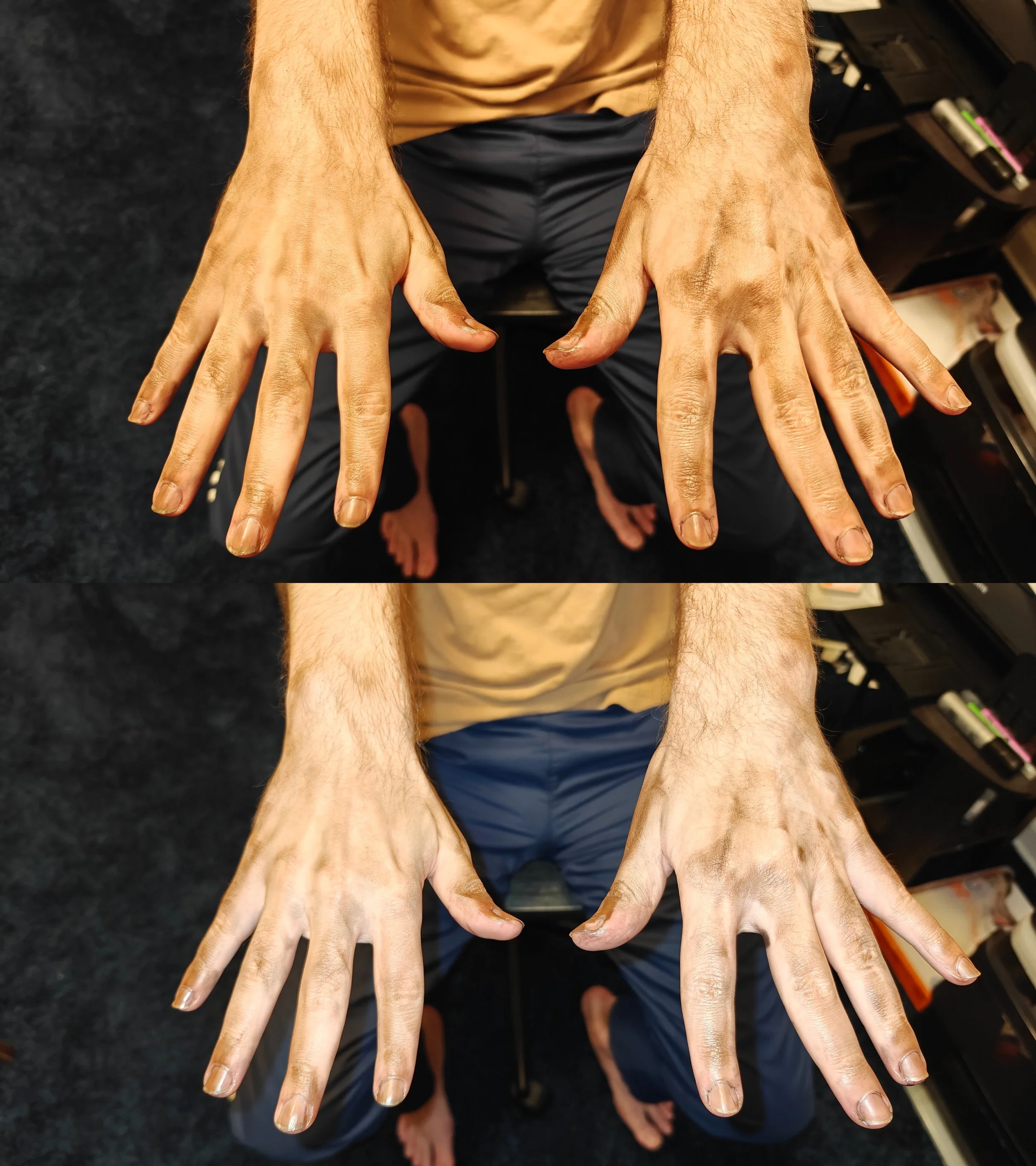 After (back of hands)