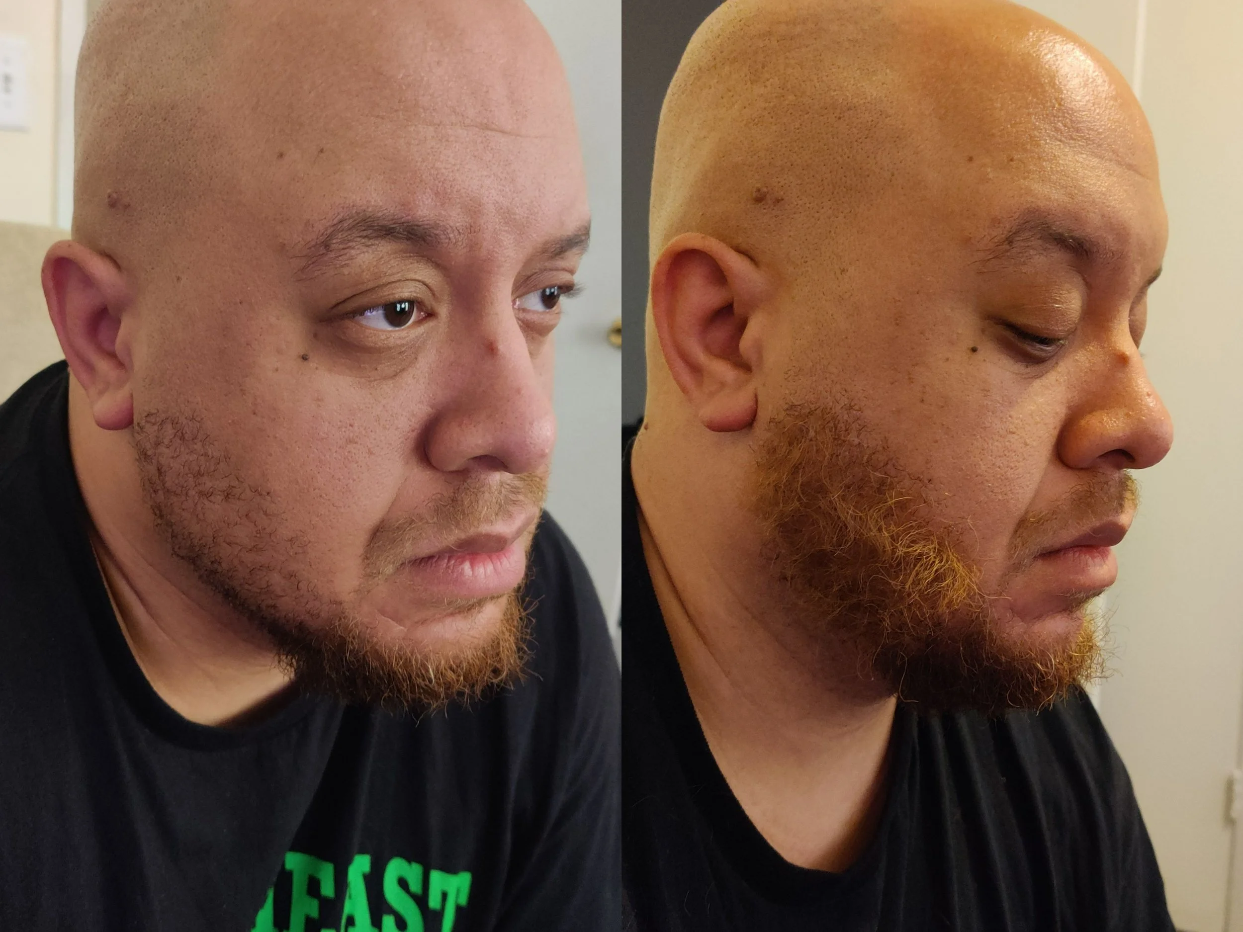 Before (left), After (right); right side