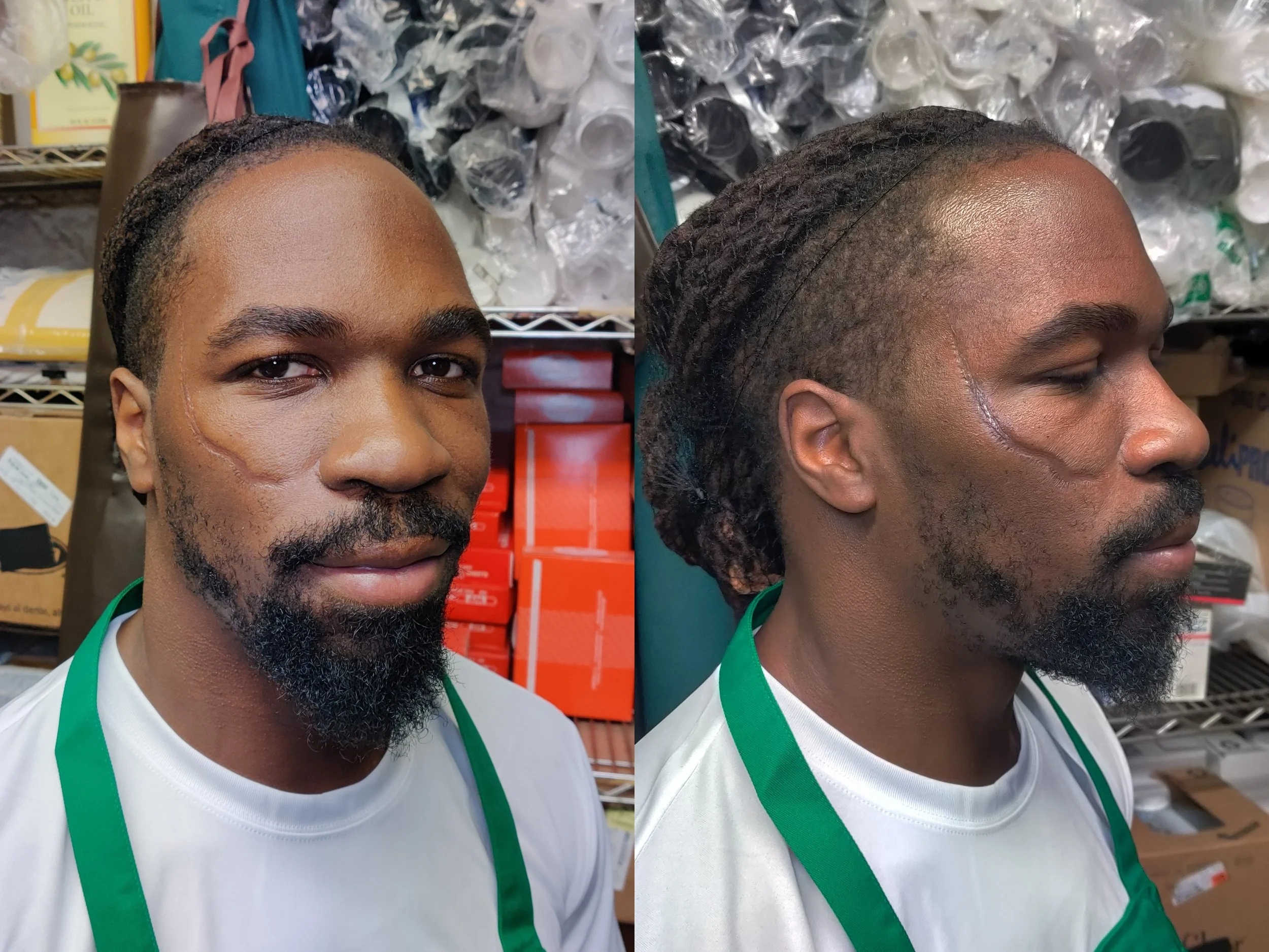 (Angle 2) New York Jets linebacker CJ Mosley after atrophic scar application using rigid collodion, probondo stipple, and alcohol activated paints. Skin prepped with witch hazel, 70% IPA, and Kryolan Pro Shield Barrier Foam.
