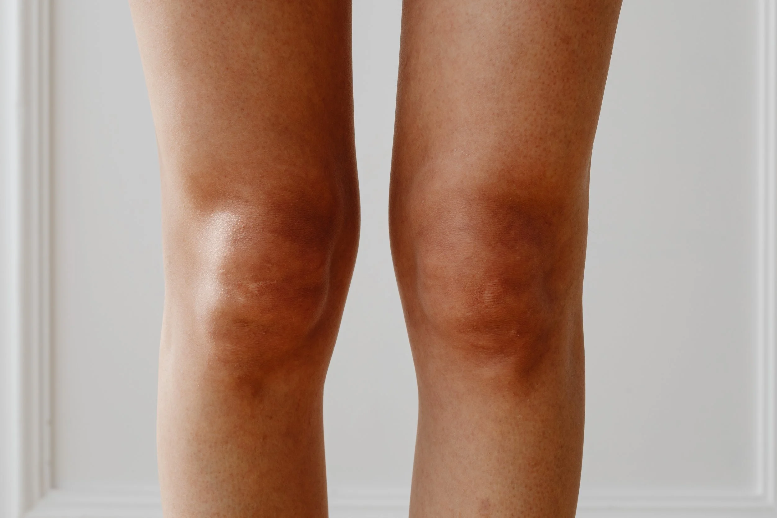 A Brief History of My Knees