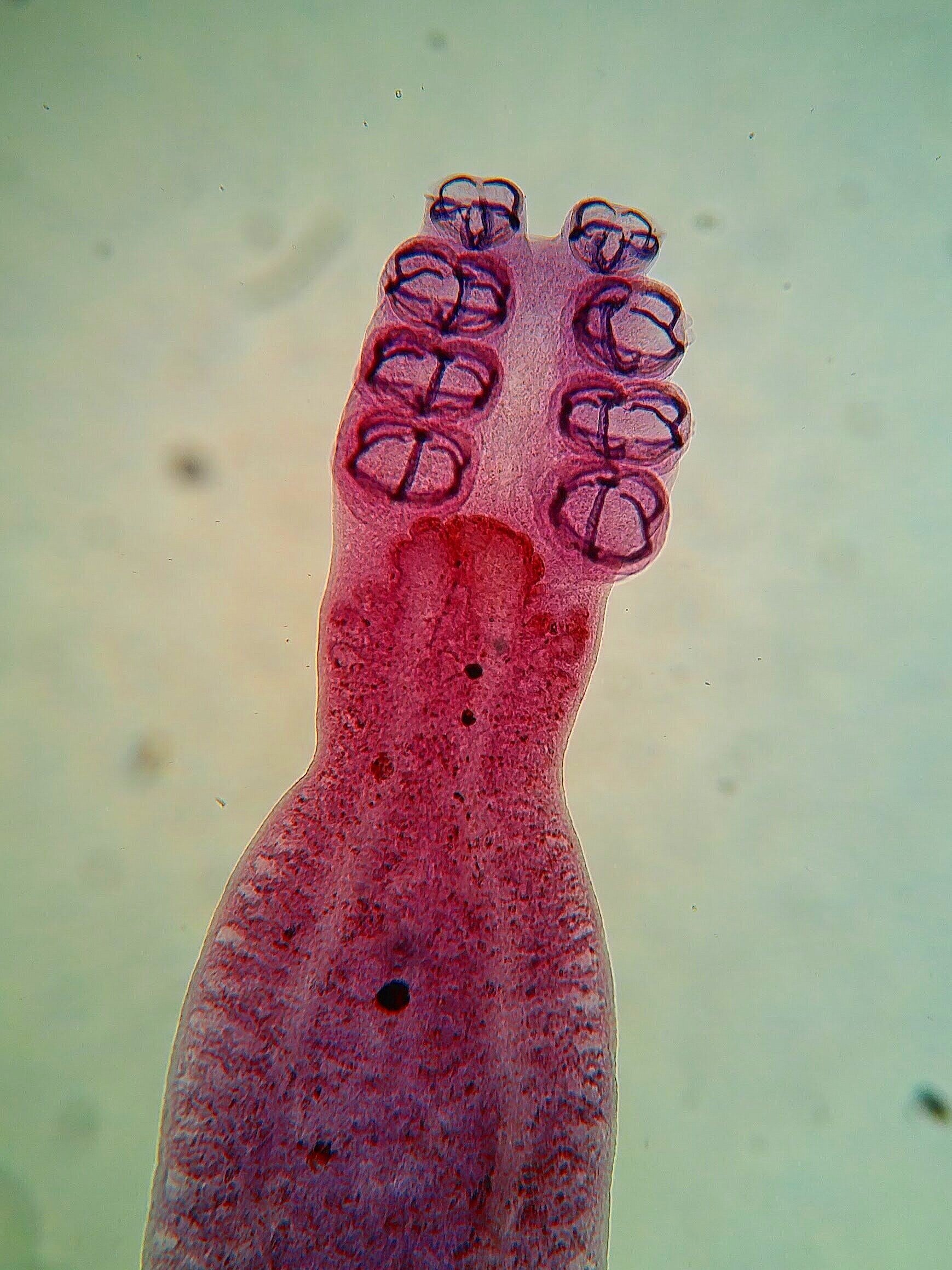   Octomacrum lanceatum.   Monogenean fluke.  