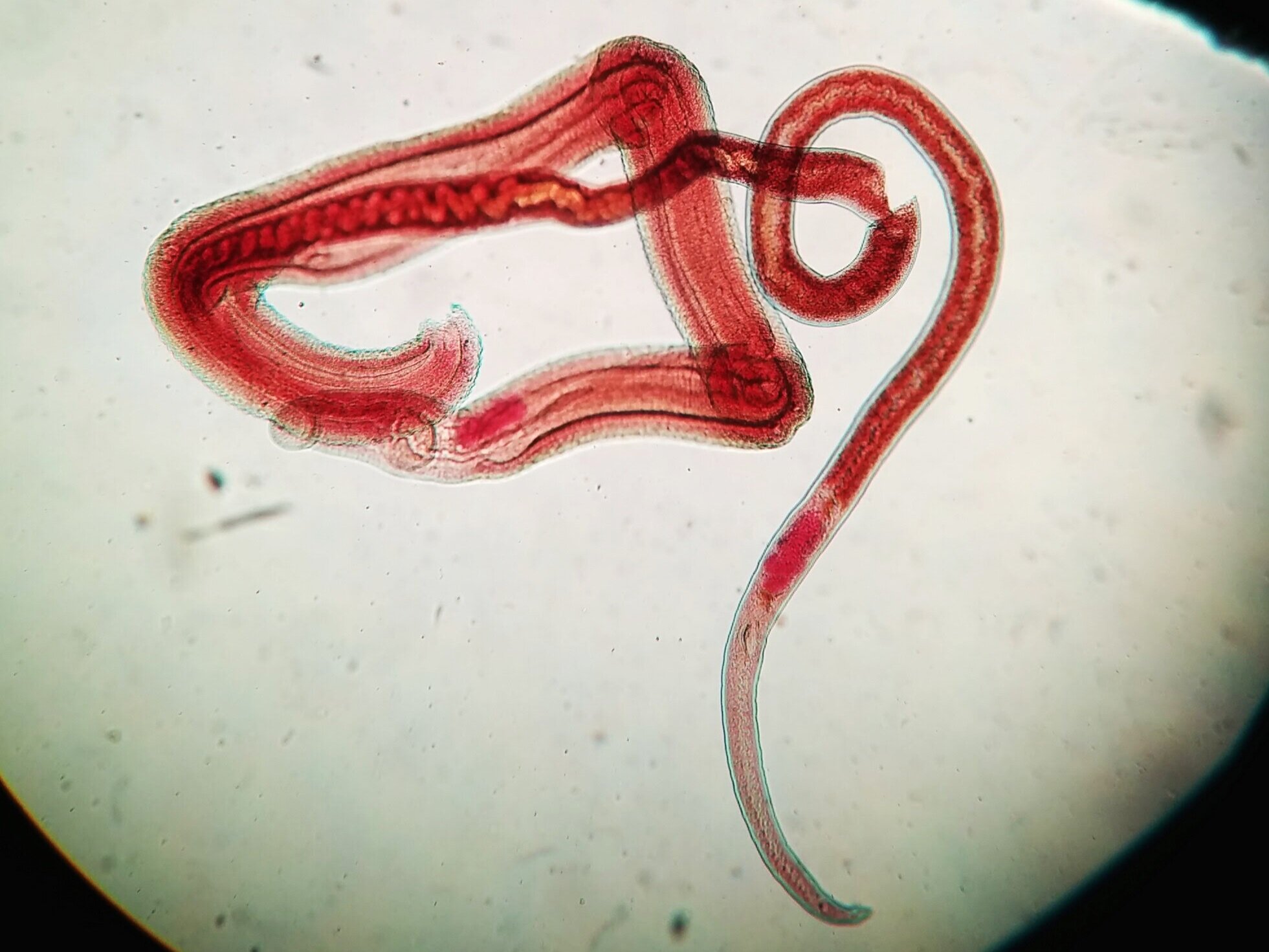   Schistosoma sp.  From purchased slide.  