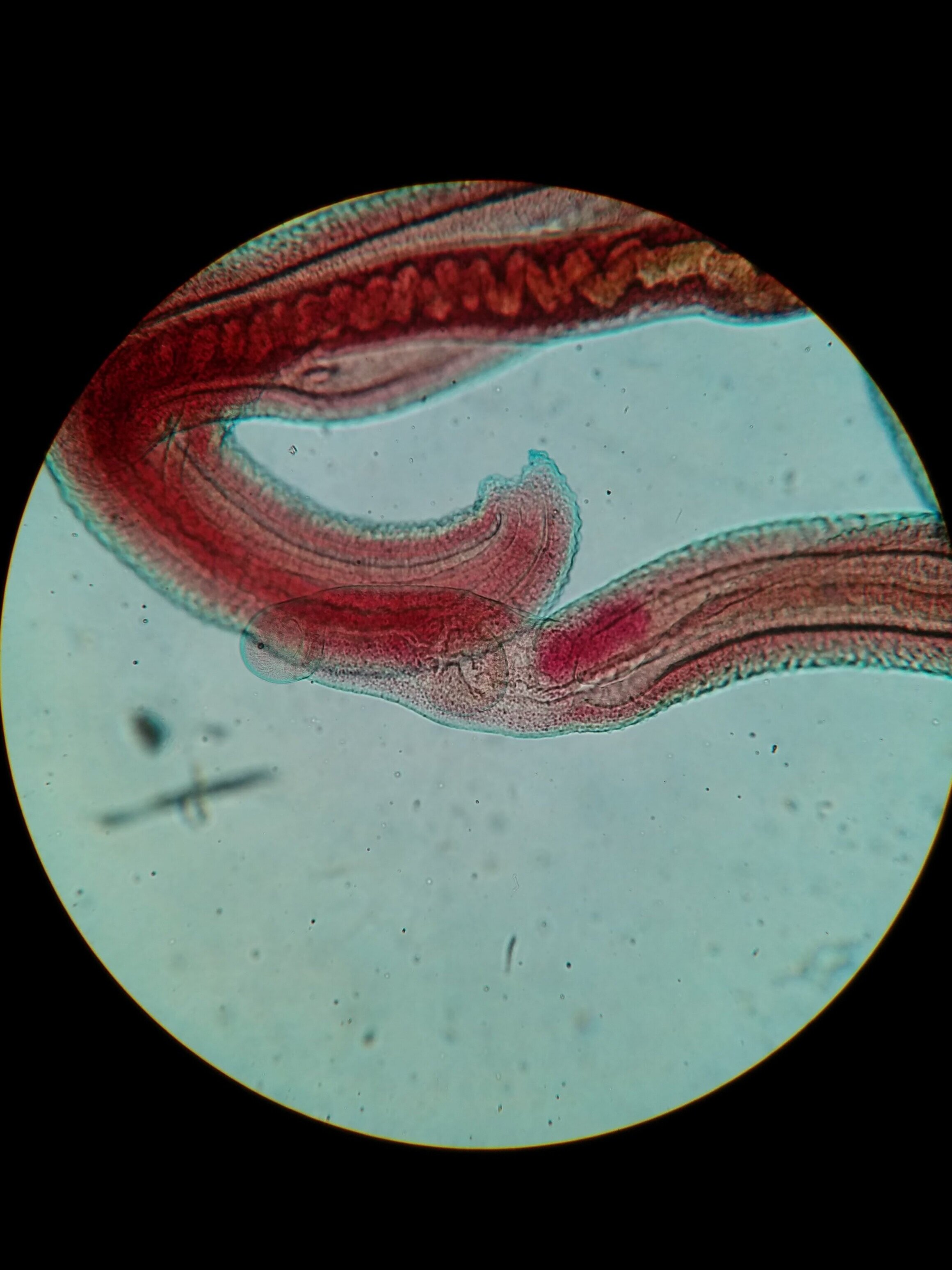   Schistosoma sp.   From purchased slide. 