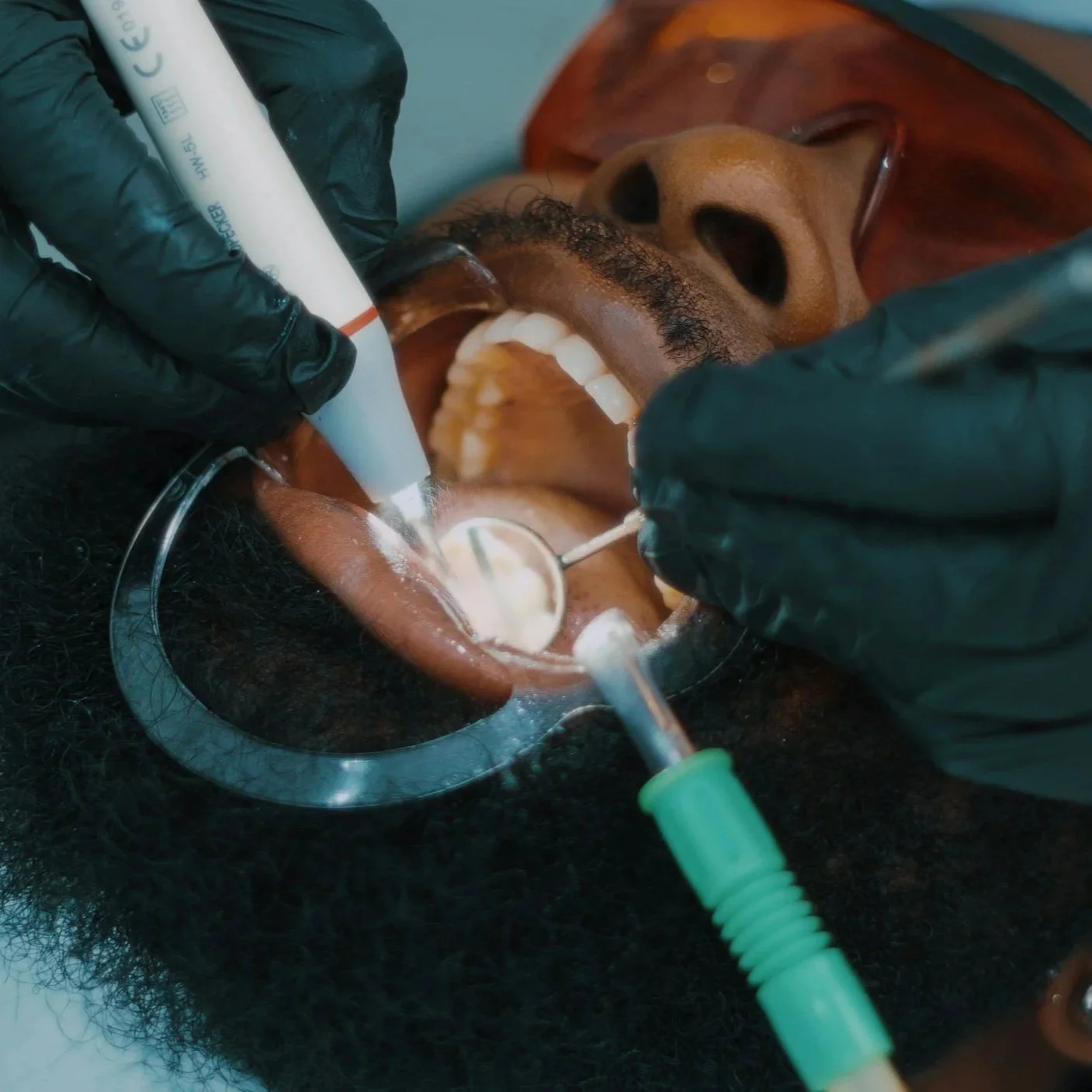 From Pain to Relief: How Emergency Dental Care Restores Smiles Fast