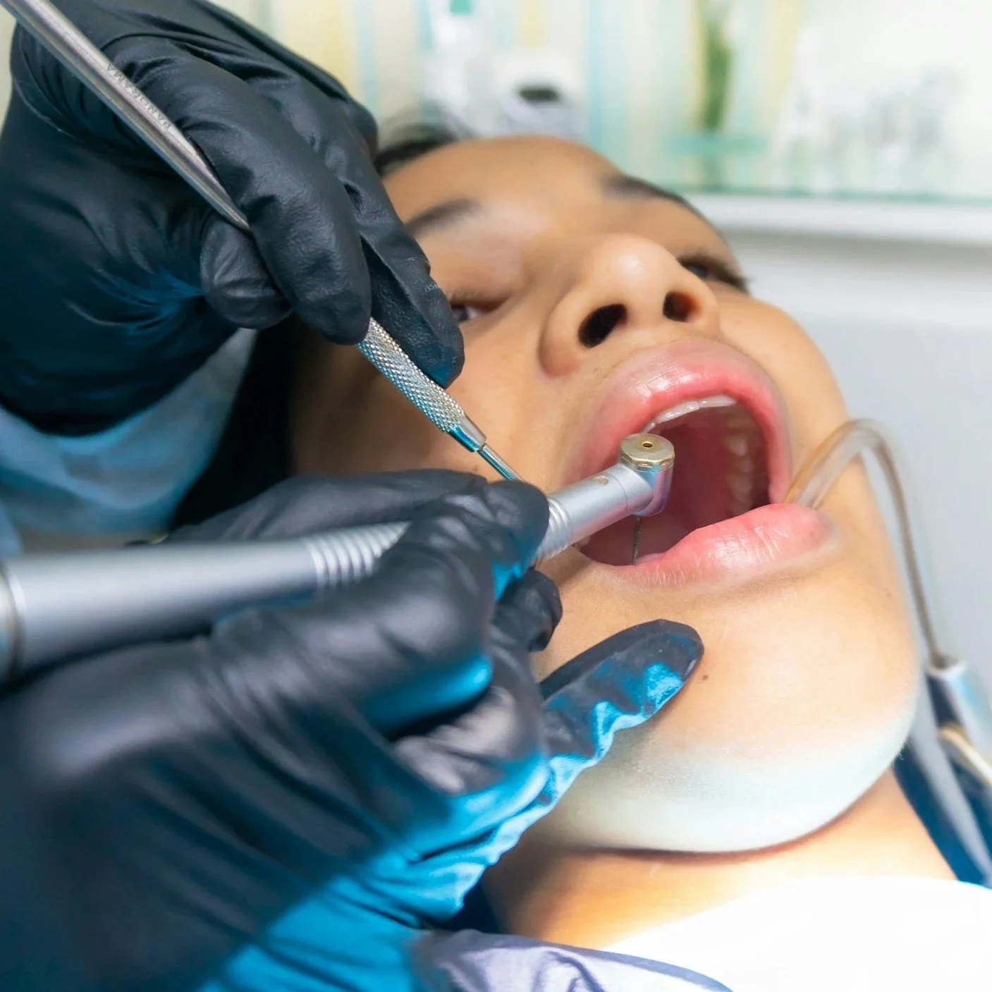 Out with the Old: The Truth About Tooth Extractions
