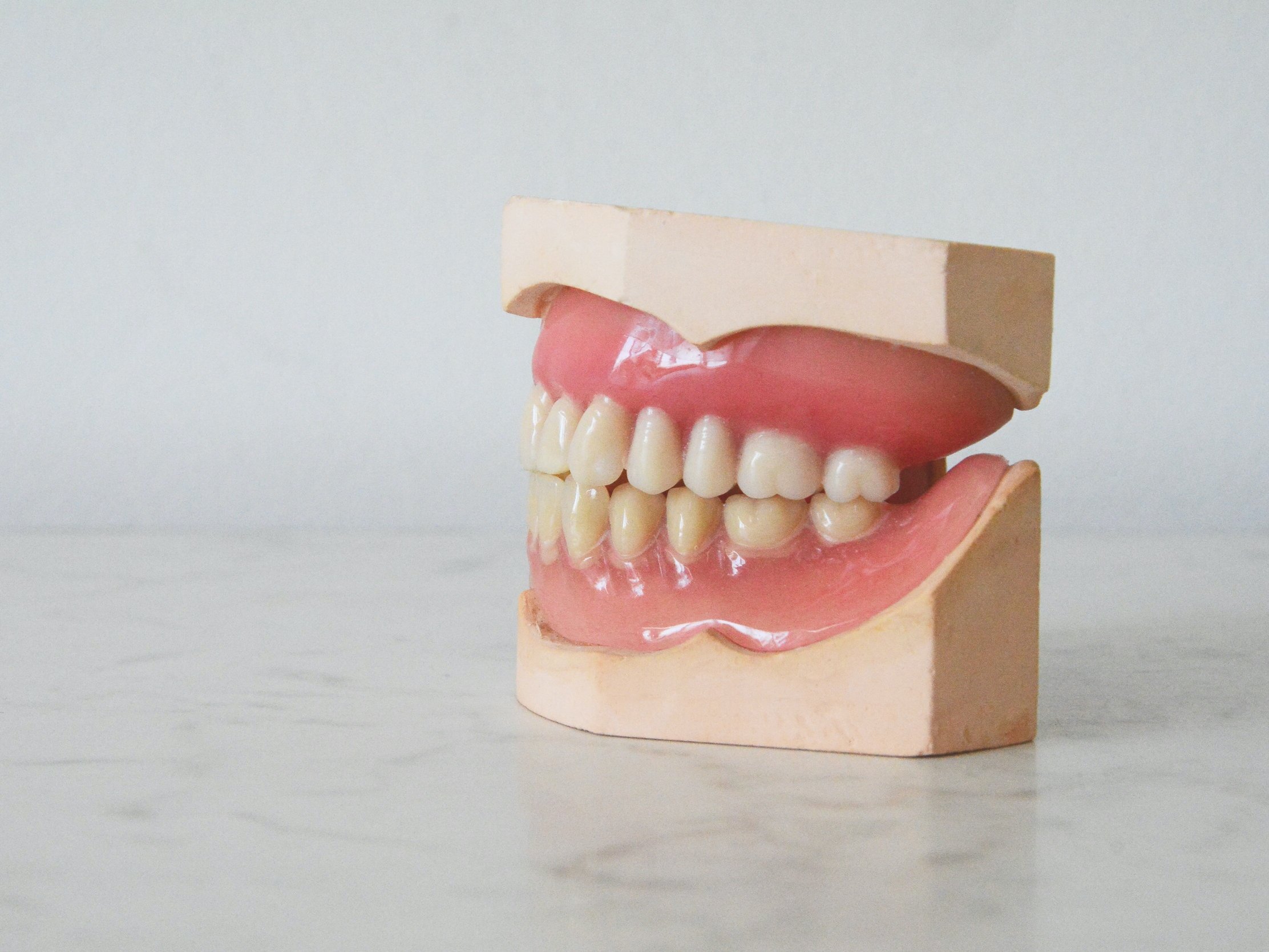 What Are Implant Retained Dentures?