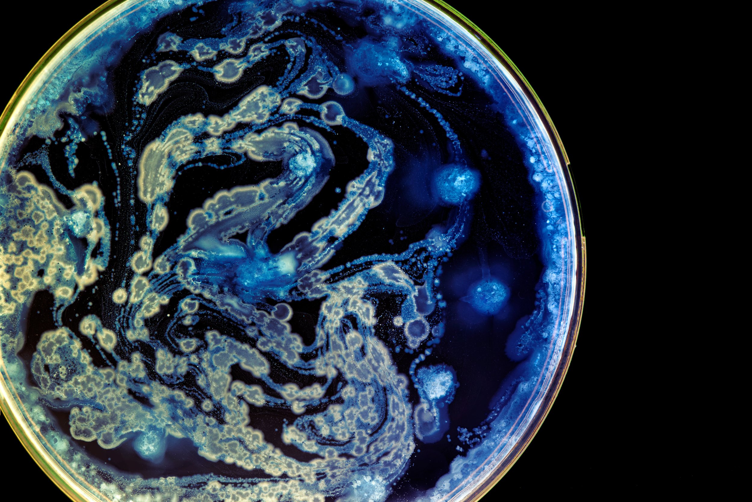 Close-up view of a petri dish with blue and yellow bacterial or fungal colonies developing in swirling and circular patterns.