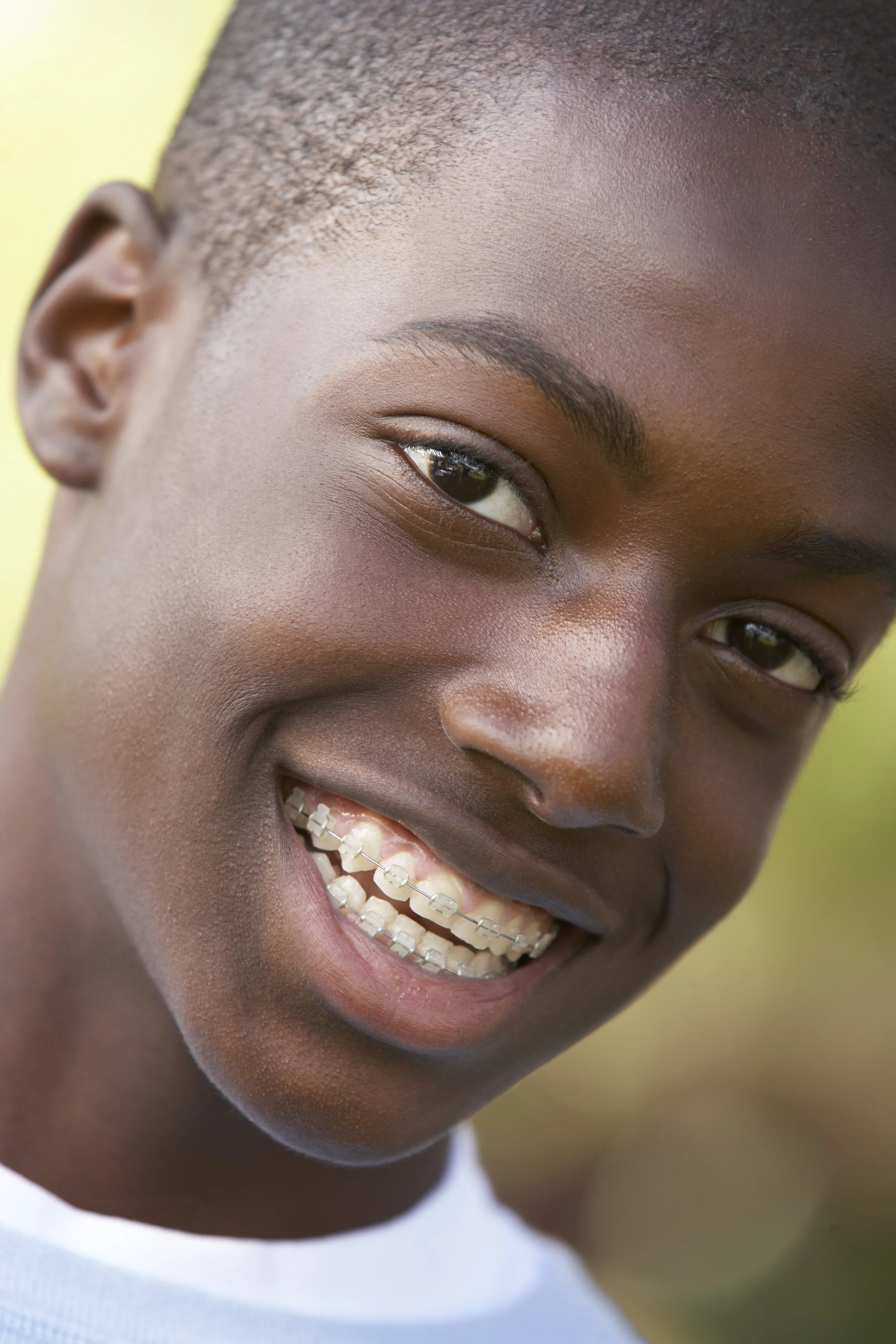 Boy with clear braces.
