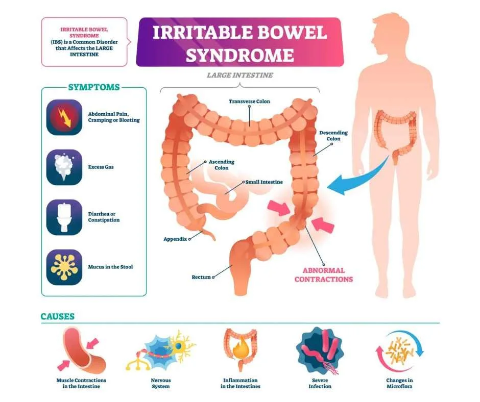 The Low FODMAP Diet for IBS, SIBO, and Chronic Digestive Symptoms