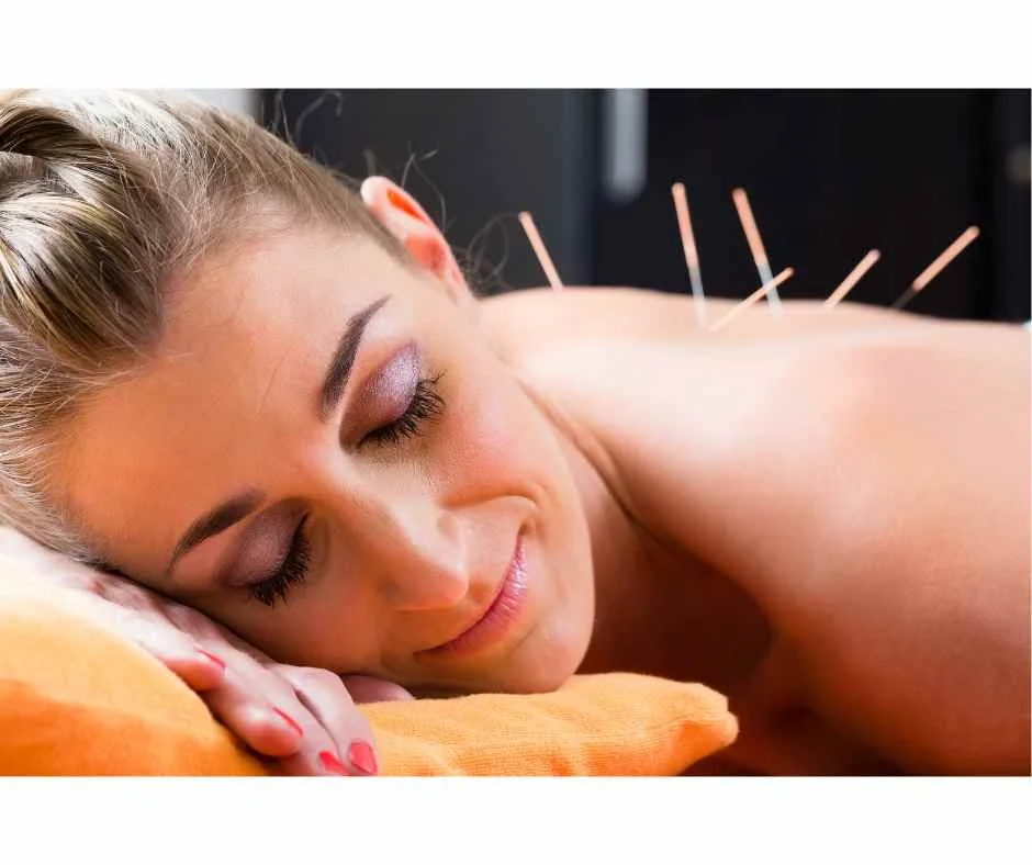 Acupuncture for PCOS: How It Supports Hormonal Regulation and Ovulation