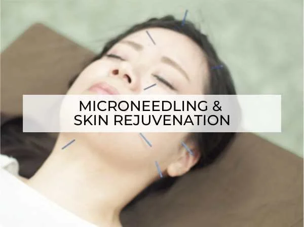 Microneedling and skin rejuvenation using integrative aesthetic care in Denver.