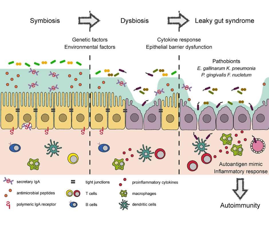 Person experiencing abdominal bloating and digestive discomfort associated with gluten-related inflammation and leaky gut