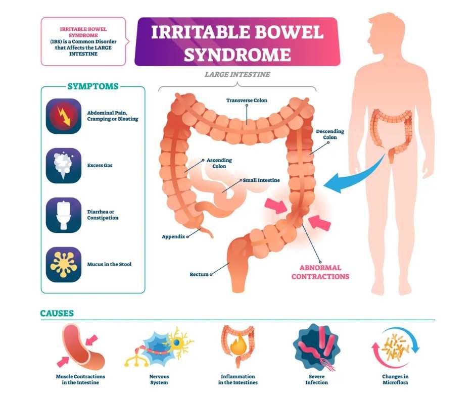 Illustration showing carbohydrate fermentation and gas production in the large intestine related to low FODMAP digestive symptoms