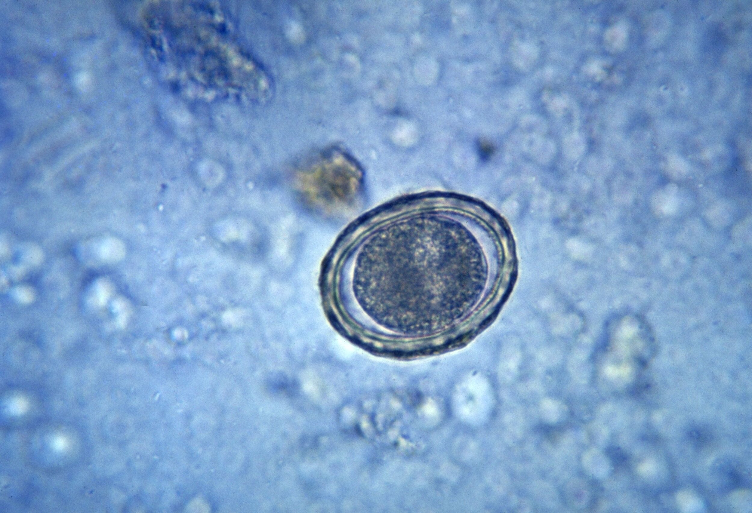 Fertilized_egg_of_Ascaris_lumbricoides_PHIL_410_lores.jpg