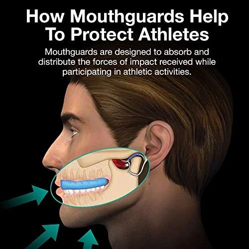 Sports Guards
Getting hit in the mouth during a sports activity could leave you or your child with broken, loose, or knocked-out teeth. A custom-fitted mouthguard from your dentist provides a cushioning barrier between the teeth and soft tissue of th