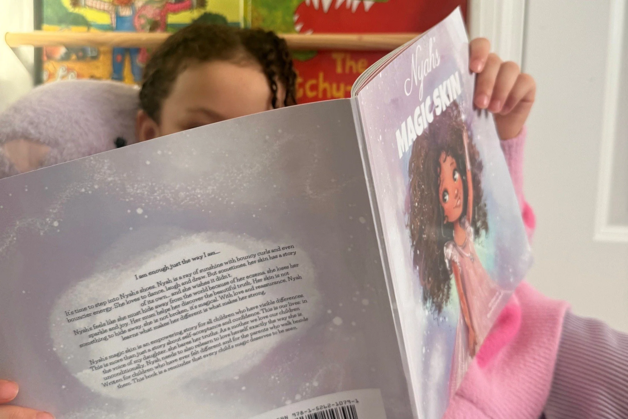 Why I wrote Nyah's Magic Skin: a parent's perspective on ezcema, visible differences and children’s mental health