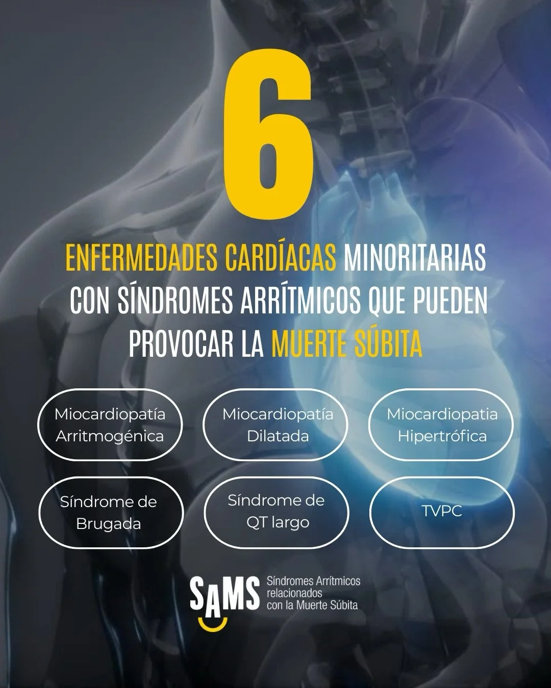 &iquest;Qu&eacute; son los s&iacute;ndromes arr&iacute;tmicos relacionados con la muerte s&uacute;bita?
Pues son aquesllas patolog&iacute;as del coraz&oacute;n de origen gen&eacute;tico que normalmente pasan inadvertidas. 

Hoy os damos una pincelada