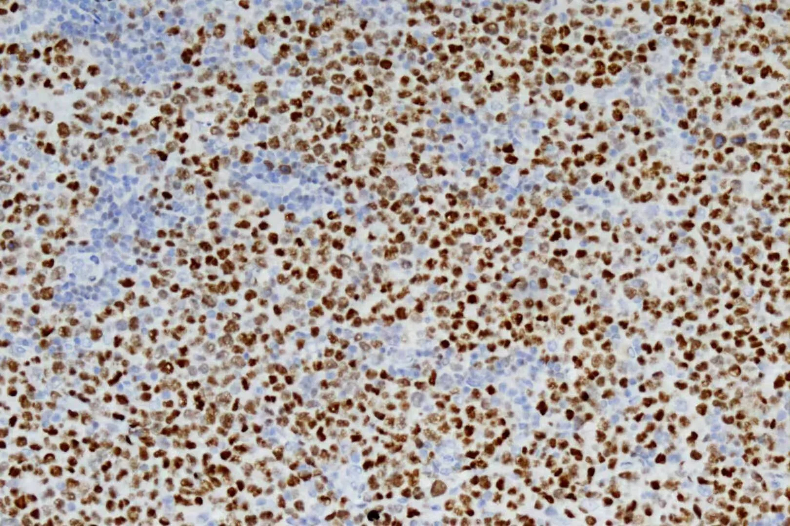 免疫组化-immunohistochemistry.jpg