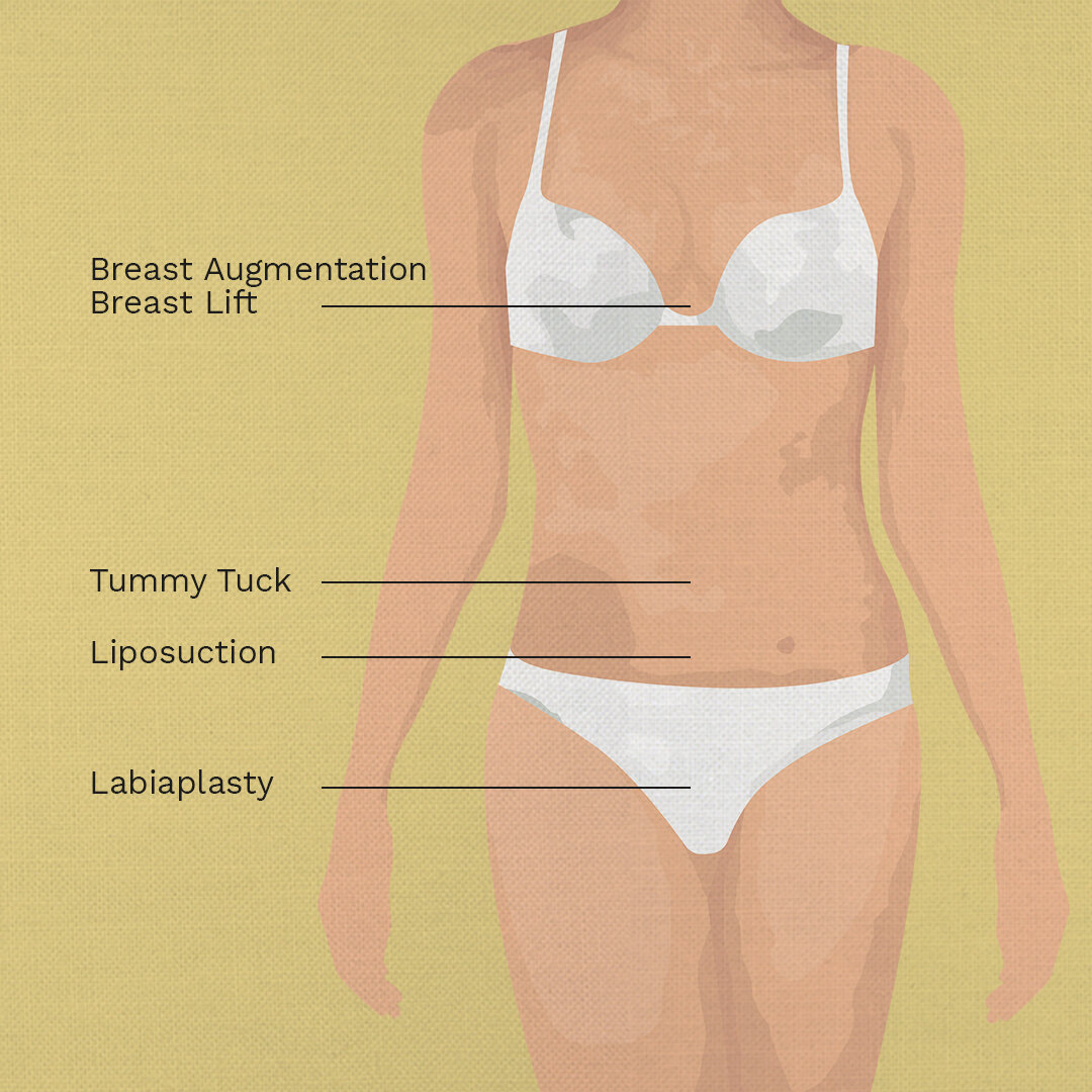 A Mom's Reason For Breast Augmentation.
