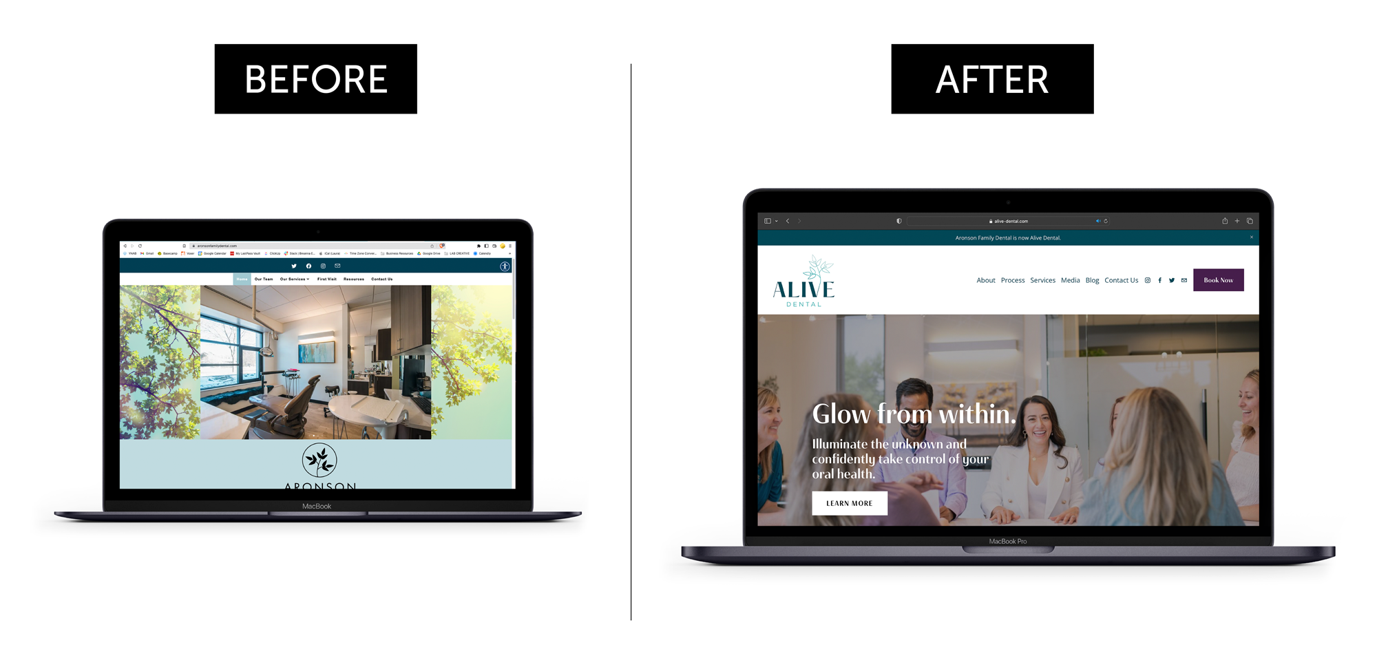 MacBook displaying the old and new Alive Dental website designs side by side, highlighting the strategic visual updates that support a more valuable and exit-ready brand.