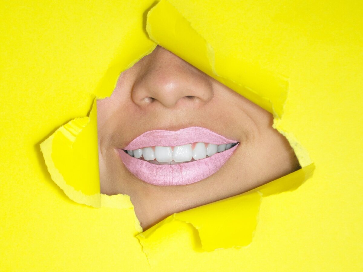 Turn Your Tooth White Again with Internal Bleaching