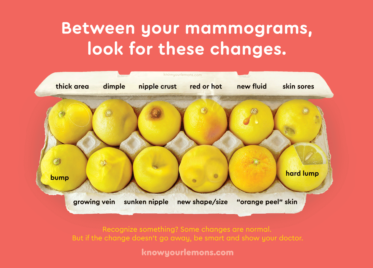 recherche fondation know your lemons