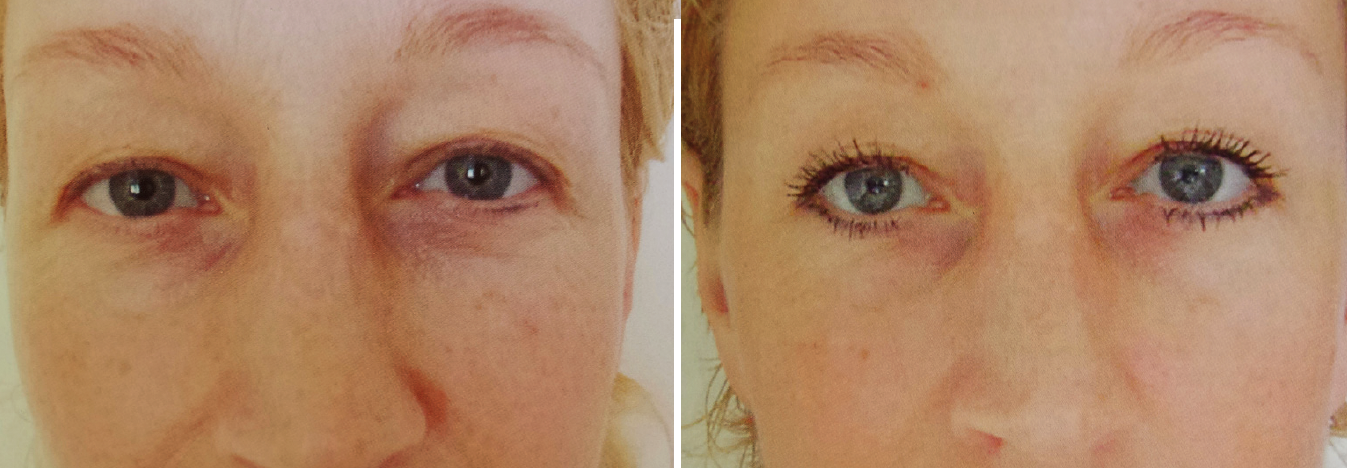 CIT_Eyes_2_BeforeAfter.png