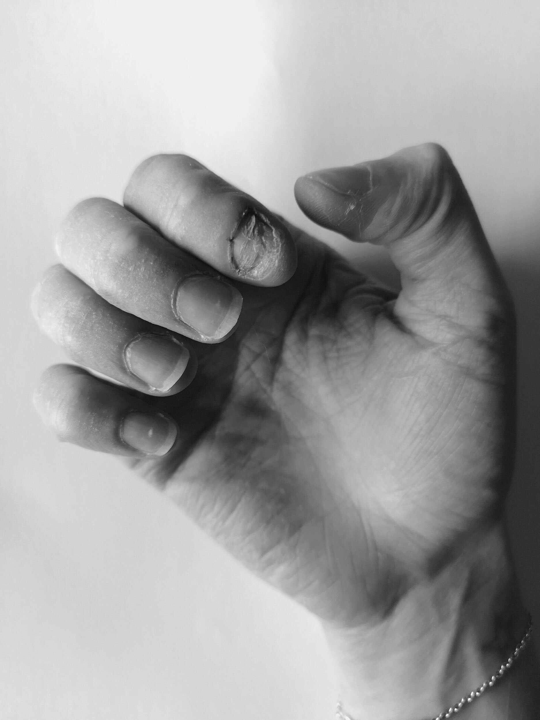 WORLD MENTAL HEALTH DAY.