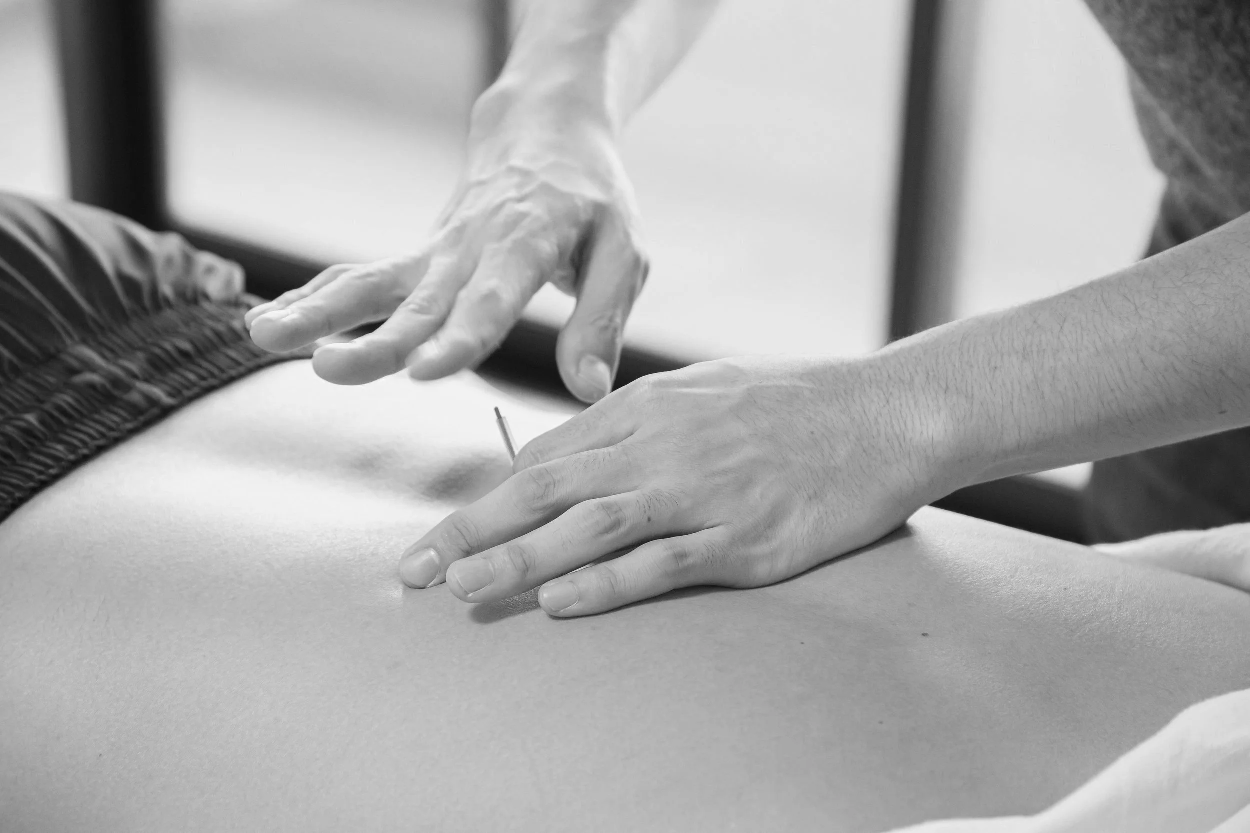 Acupuncture — Willow Massage & Wellness