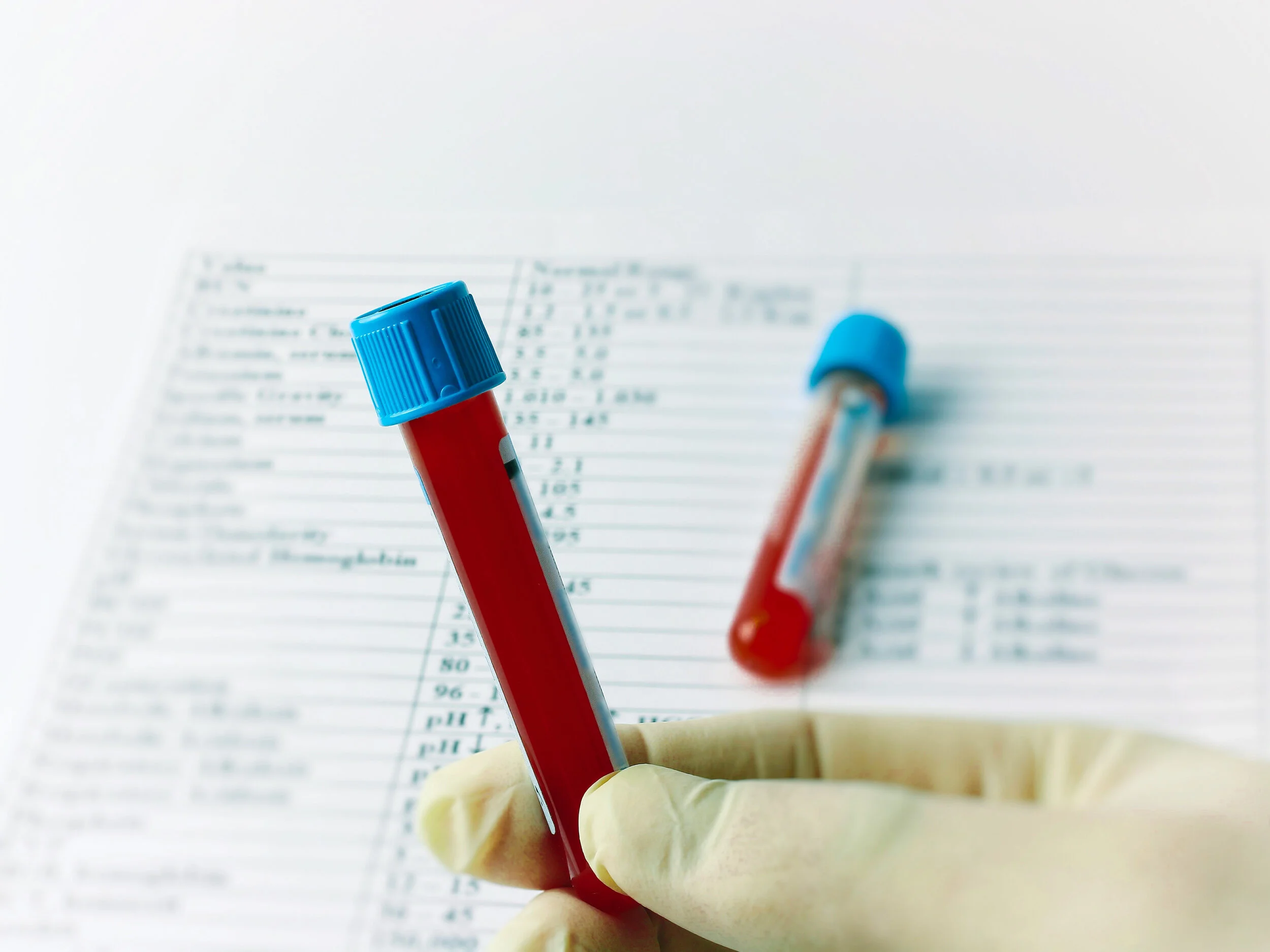 Do you Understand your Blood Work? Why Normal does not always mean Healthy!