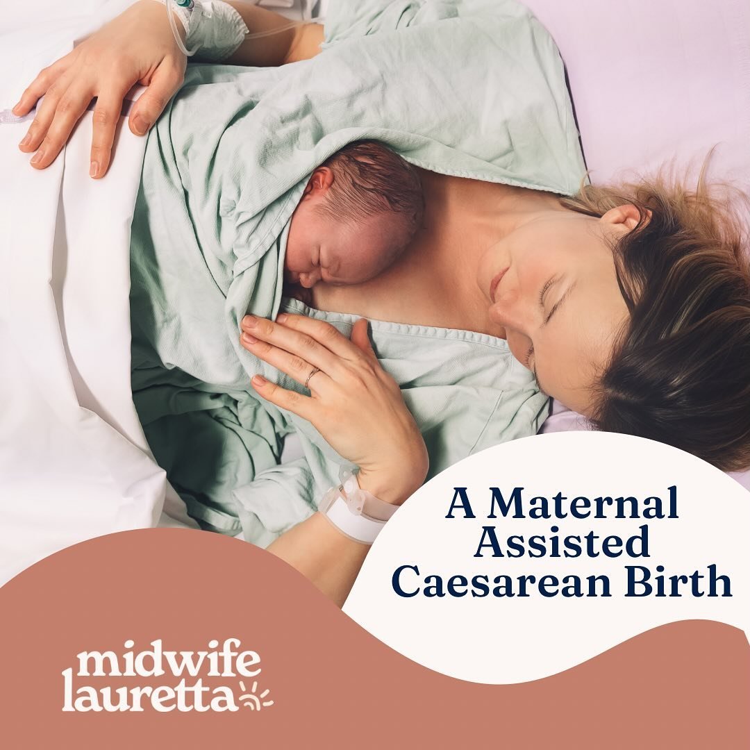 Maternal Assisted Caesarean (MAC) have you heard about these? They can give women &amp; birthing people the chance to play a more active part in their Caesarean Birth. 

As they are reasonably new, certain hospitals may have different criteria for el