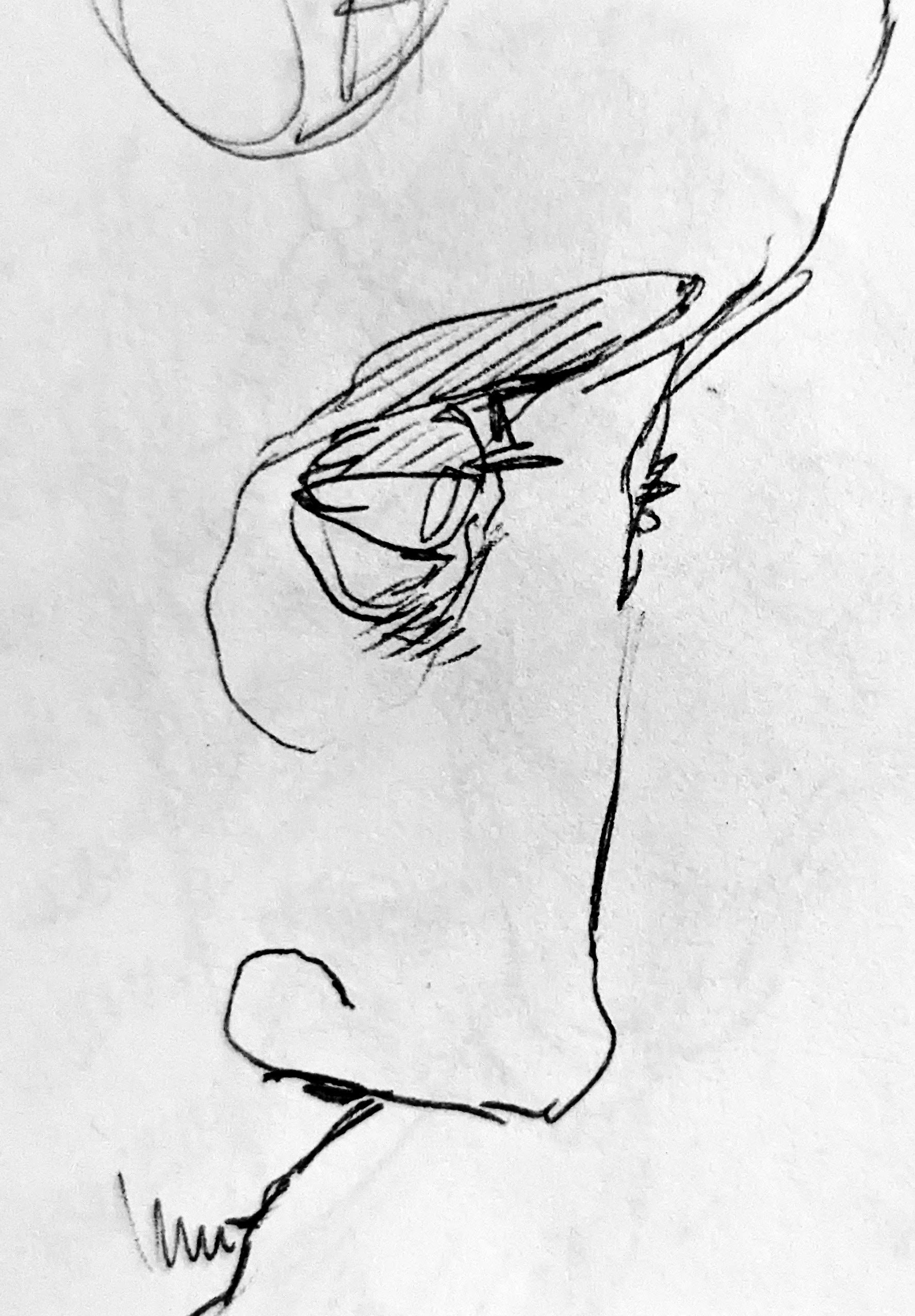 Watery eyes