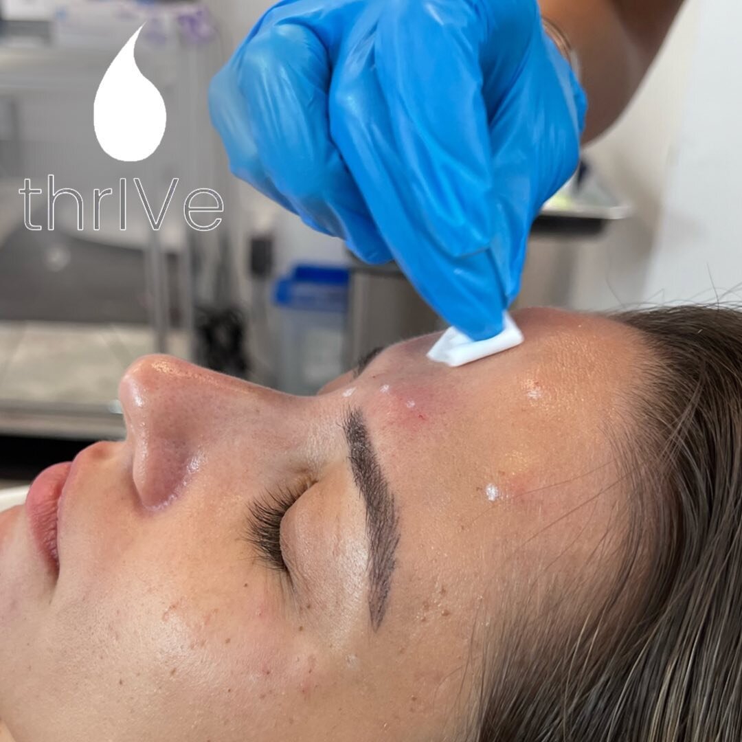 When is it time for Botox? ⌛️

🌟Here are 5 signs that you could benefit from this treatment! 

-You have crow&rsquo;s feet or &ldquo;worry lines&rdquo; around your eyes

-You are experiencing a droopy brow

-You have lines above your upper lip

-You