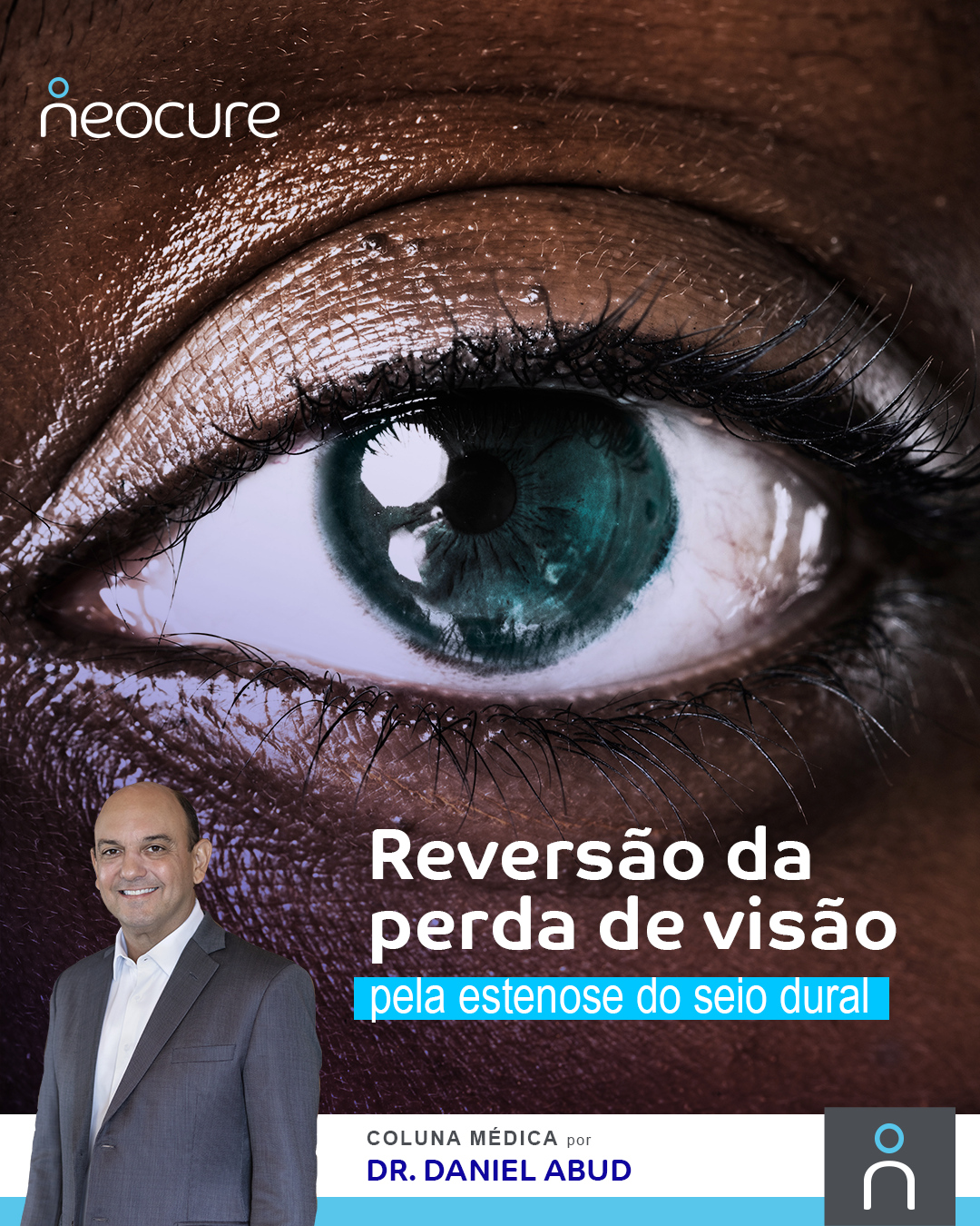 Reversão do prejuízo à visão pela estenose do seio dural