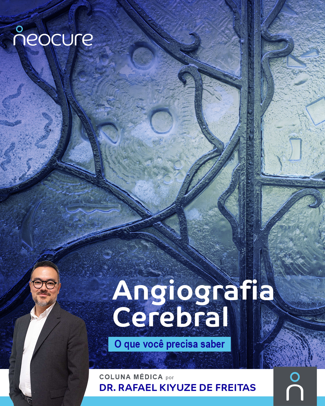 Angiografia Cerebral: O Que Você Precisa Saber